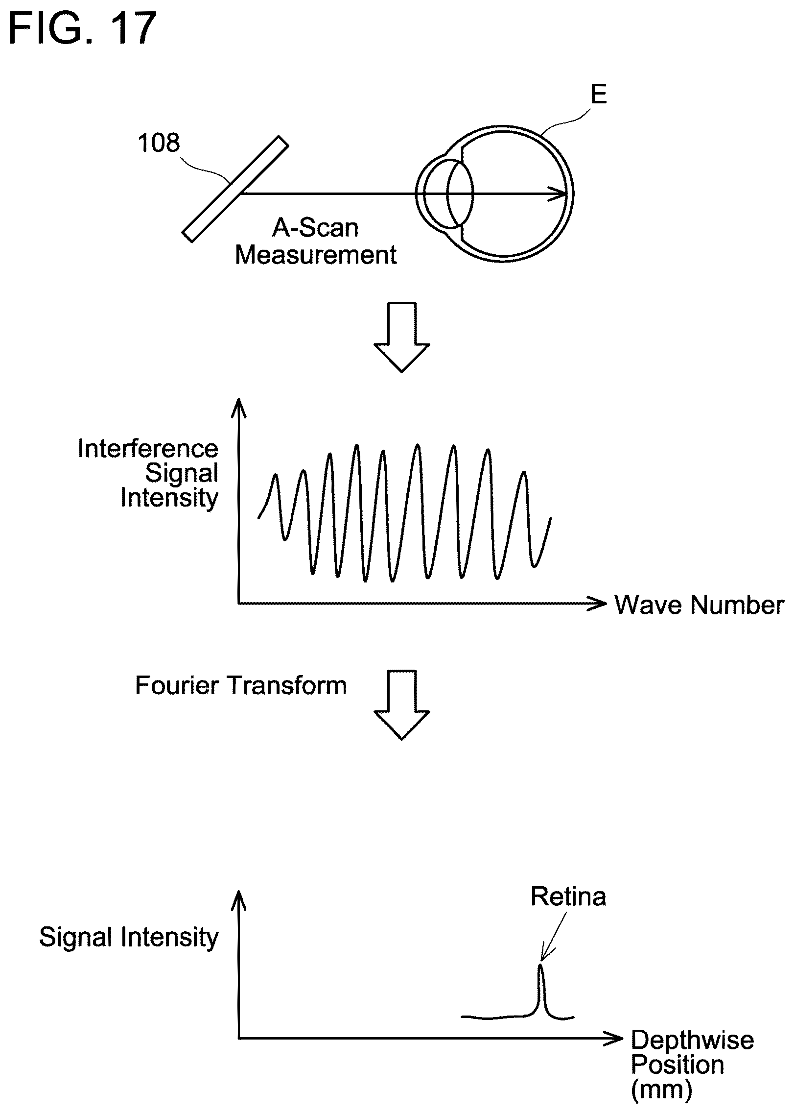 Patent US12376743 Figure 17 – Ophthalmic device
