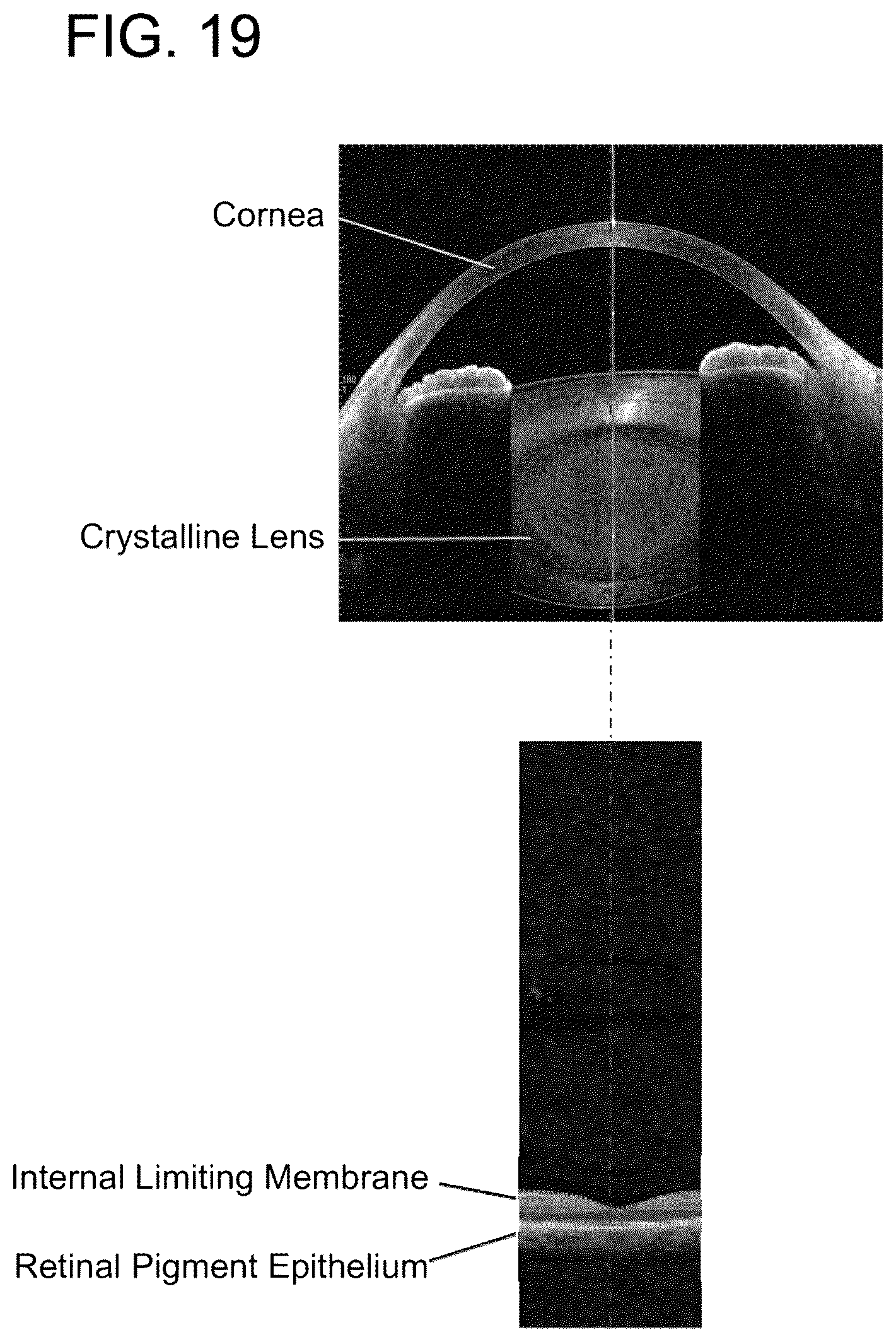 Patent US12376743 Figure 19 – Ophthalmic device
