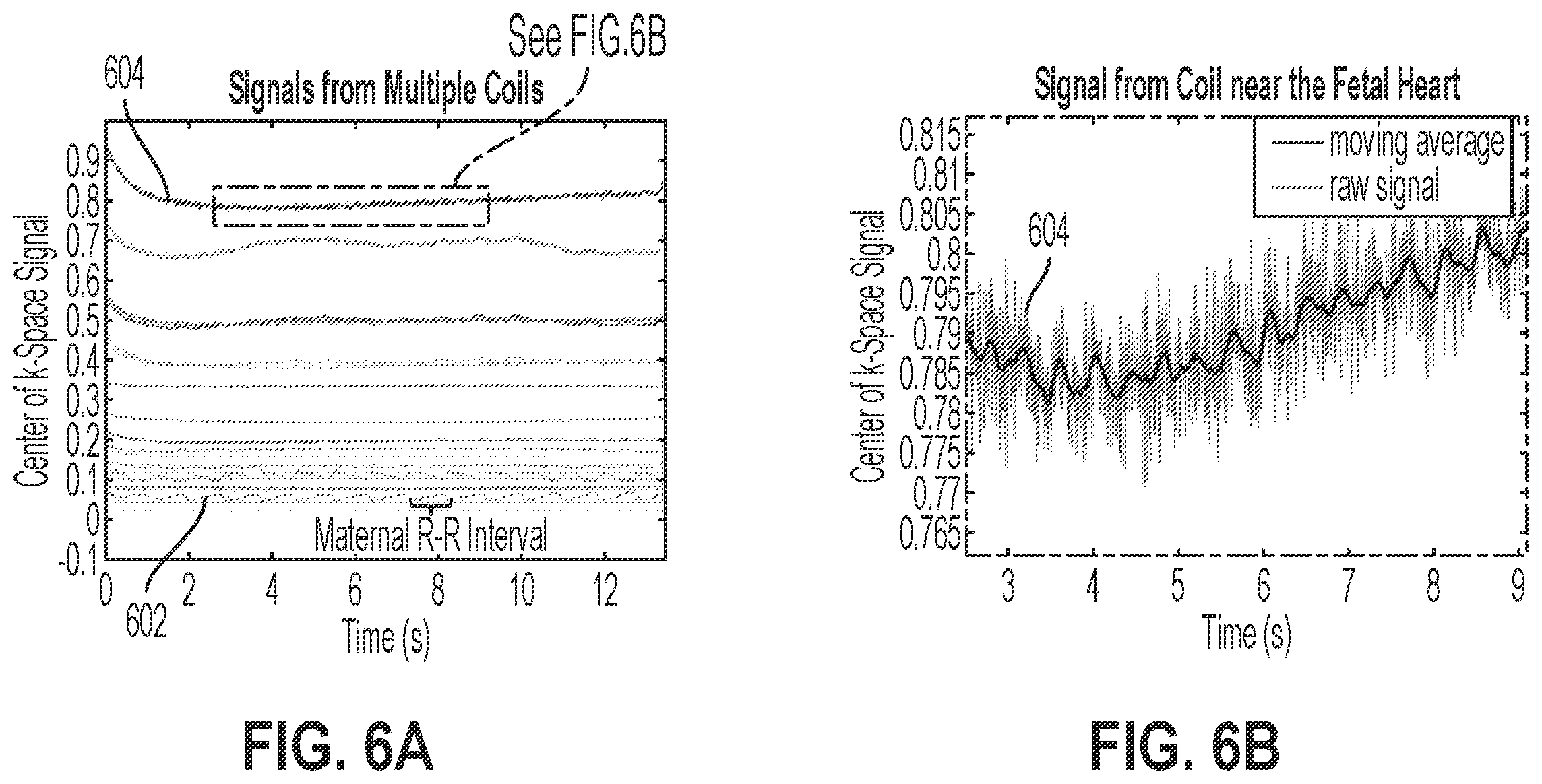 Patent US12376748 Figure 6 – Fetal cardiac MRI using self-gating with a cartesian k-space trajectory