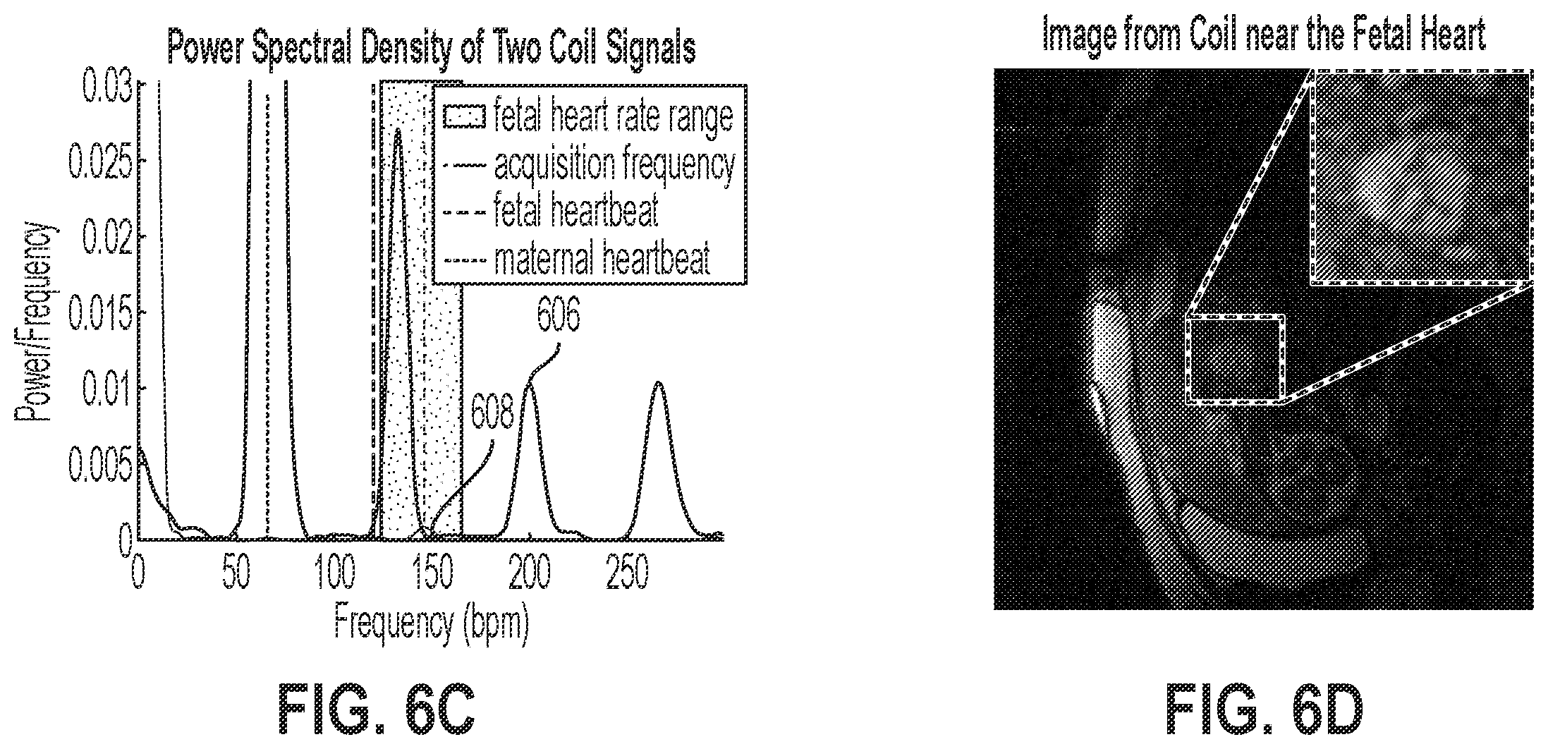 Patent US12376748 Figure 7 – Fetal cardiac MRI using self-gating with a cartesian k-space trajectory