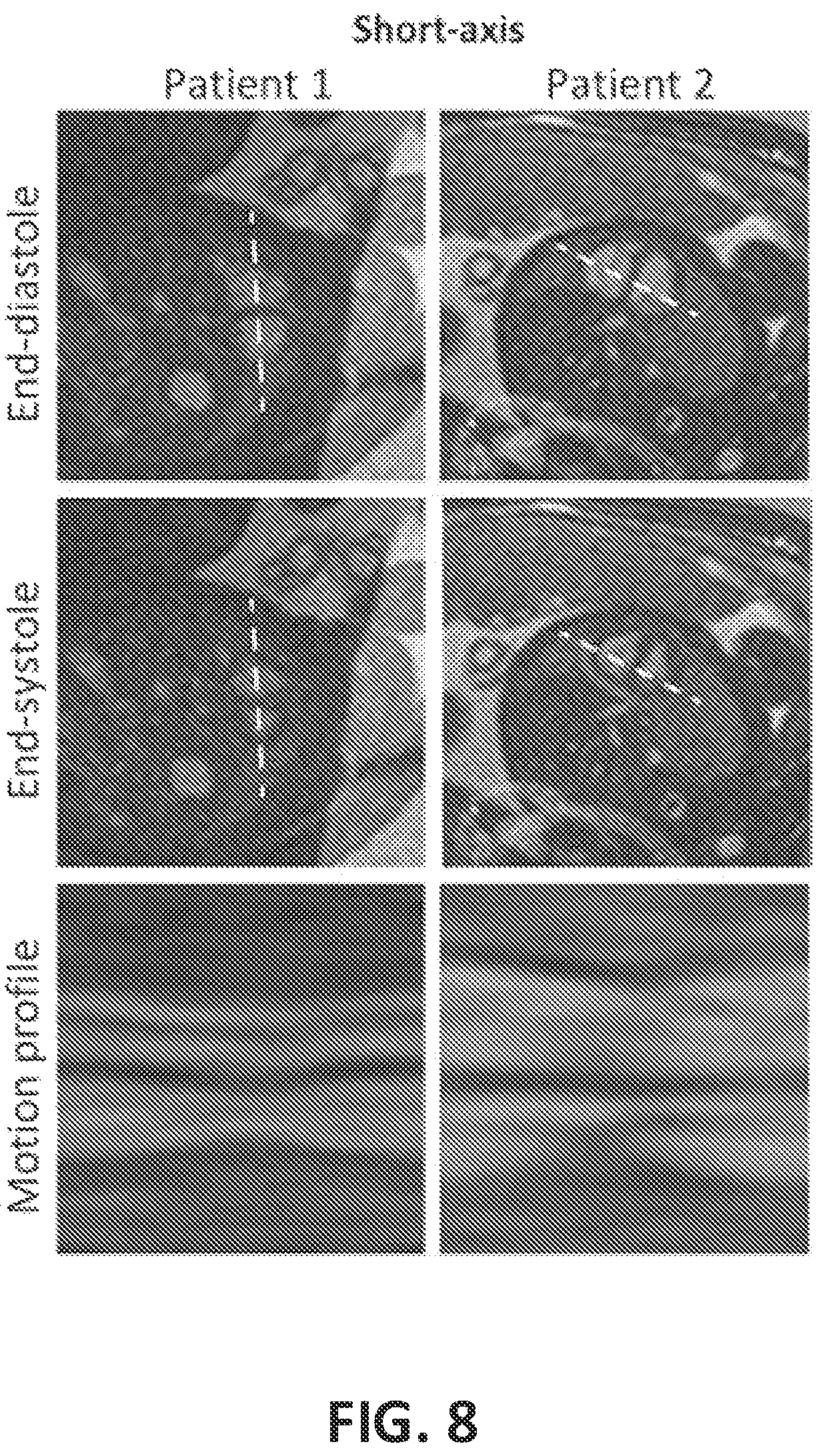 Patent US12376748 Figure 9 – Fetal cardiac MRI using self-gating with a cartesian k-space trajectory