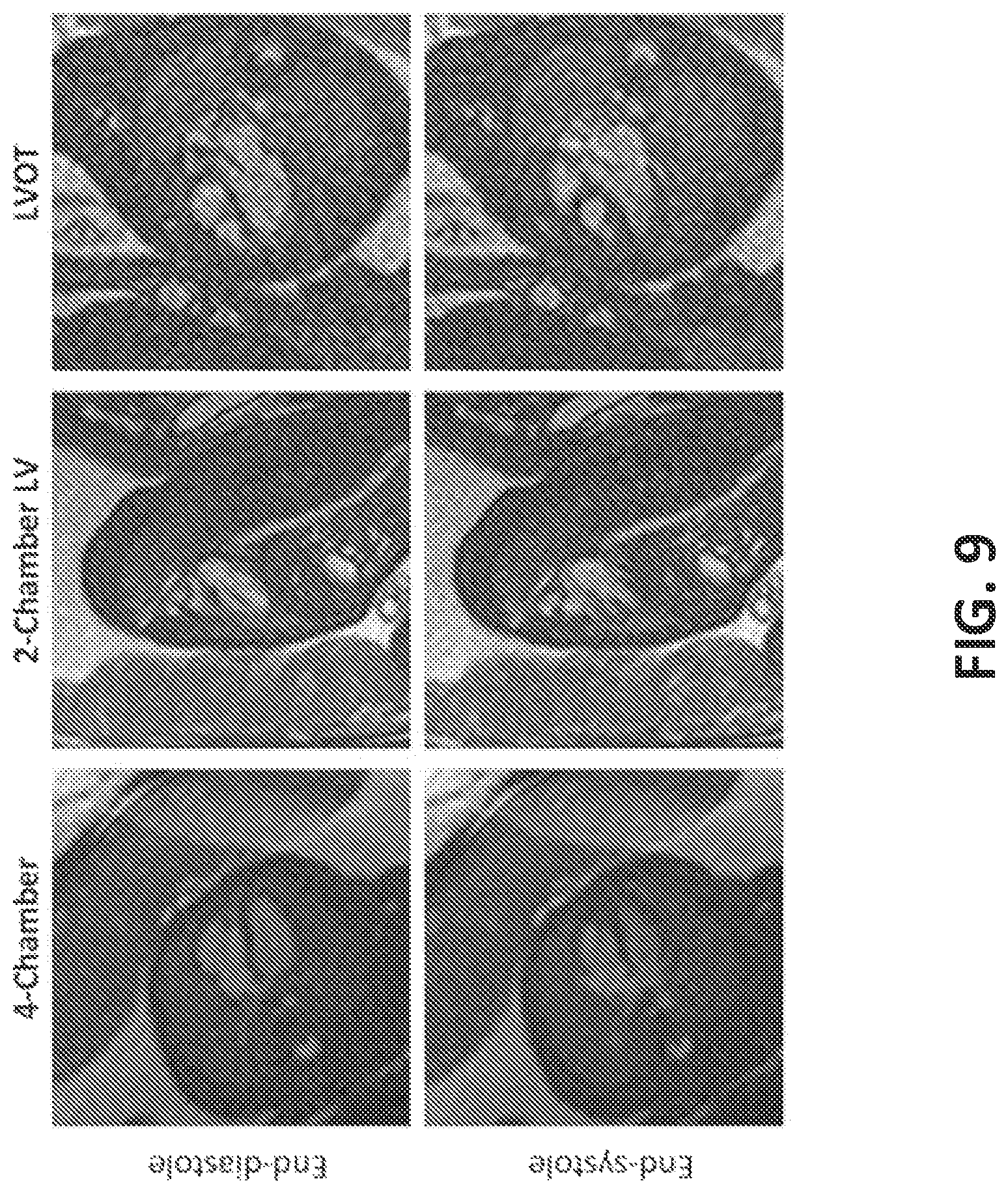Patent US12376748 Figure 10 – Fetal cardiac MRI using self-gating with a cartesian k-space trajectory