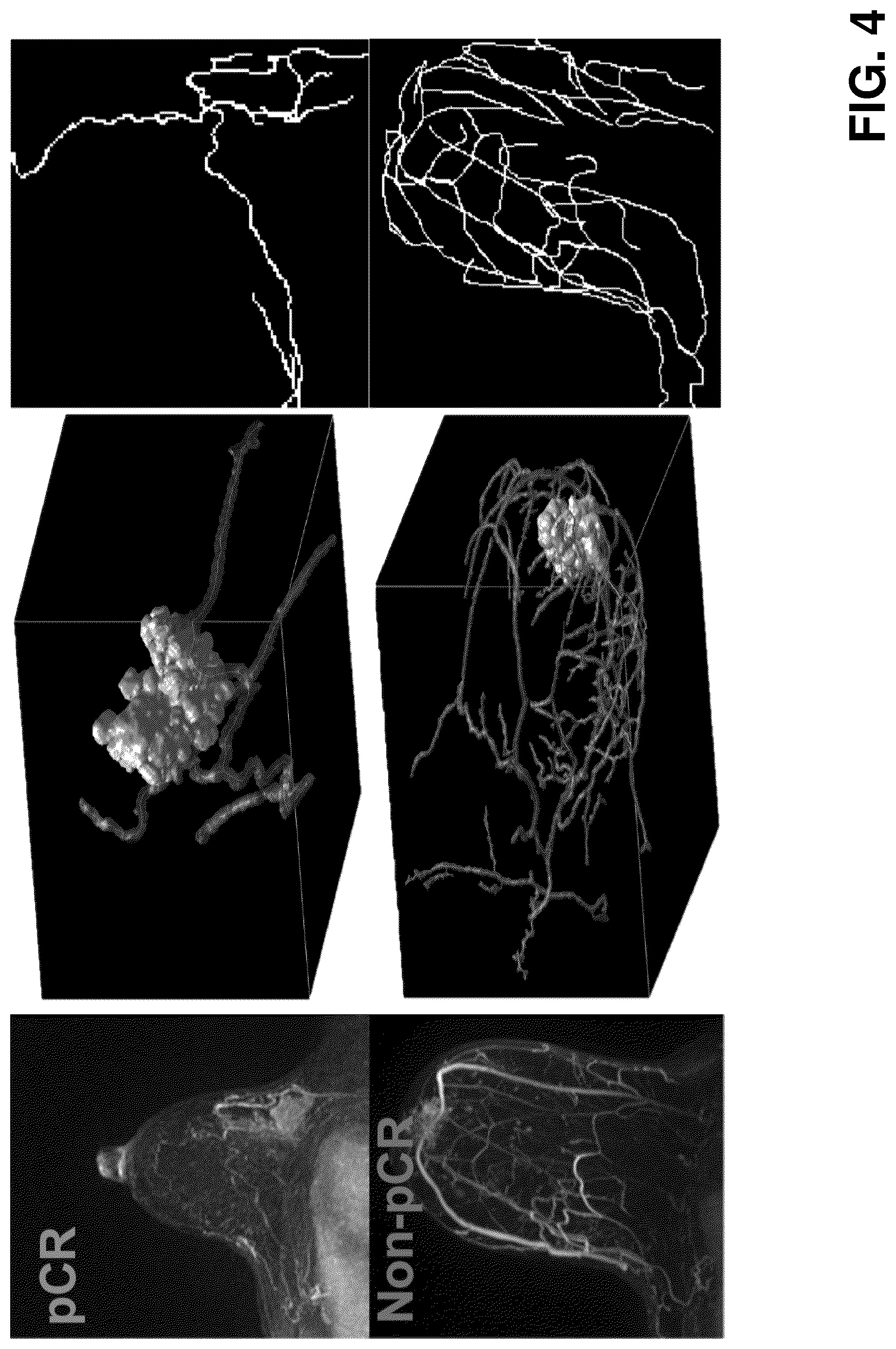 Patent US12376750 Figure 4 – Tumor characterization and outcome prediction through quantitative measurements of tumor-associated vasculature