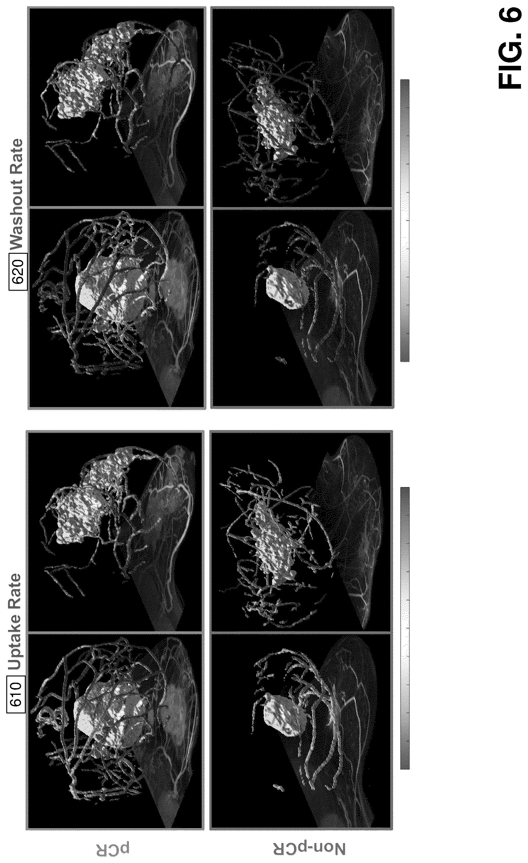 Patent US12376750 Figure 6 – Tumor characterization and outcome prediction through quantitative measurements of tumor-associated vasculature