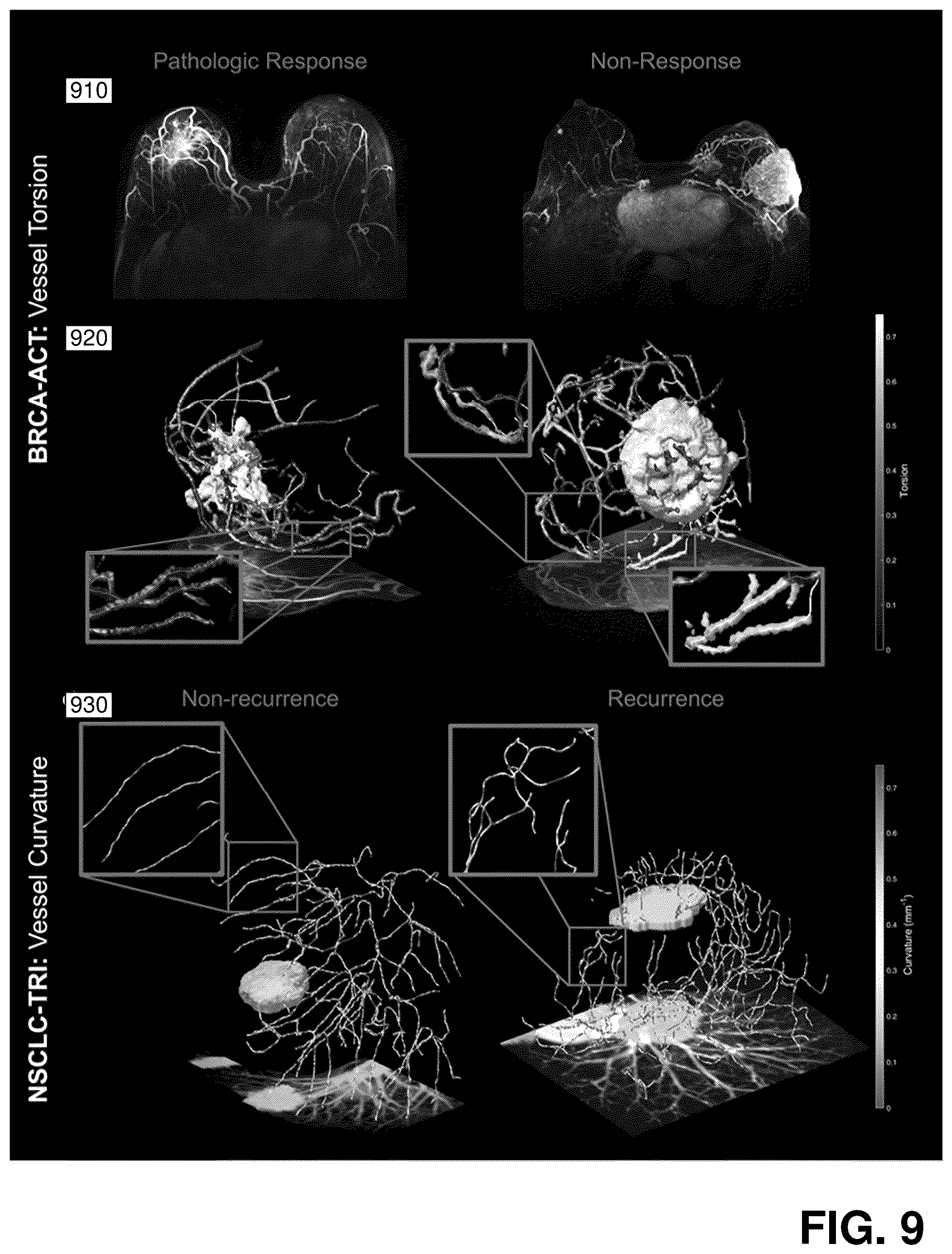 Patent US12376750 Figure 9 – Tumor characterization and outcome prediction through quantitative measurements of tumor-associated vasculature