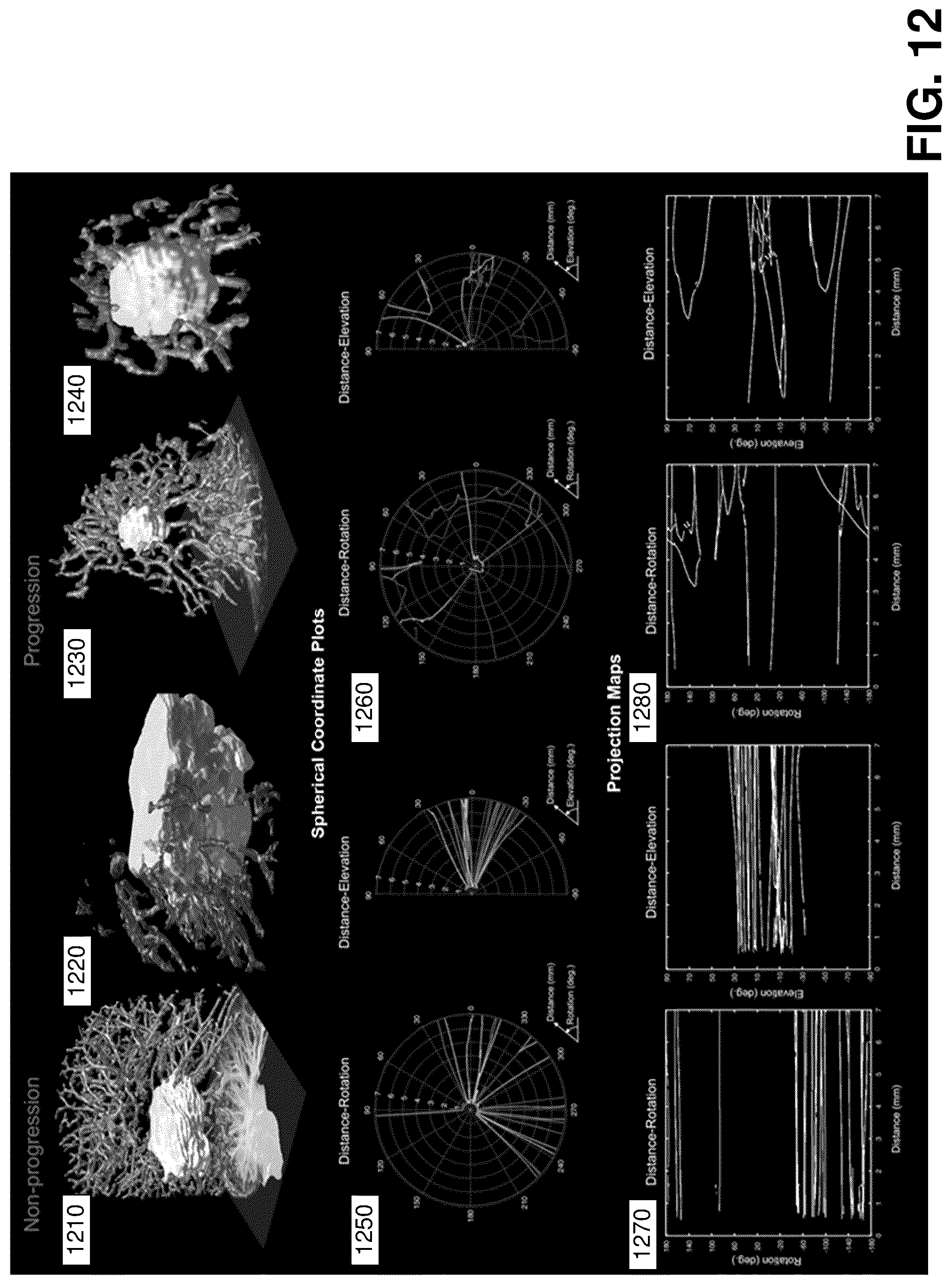 Patent US12376750 Figure 12 – Tumor characterization and outcome prediction through quantitative measurements of tumor-associated vasculature