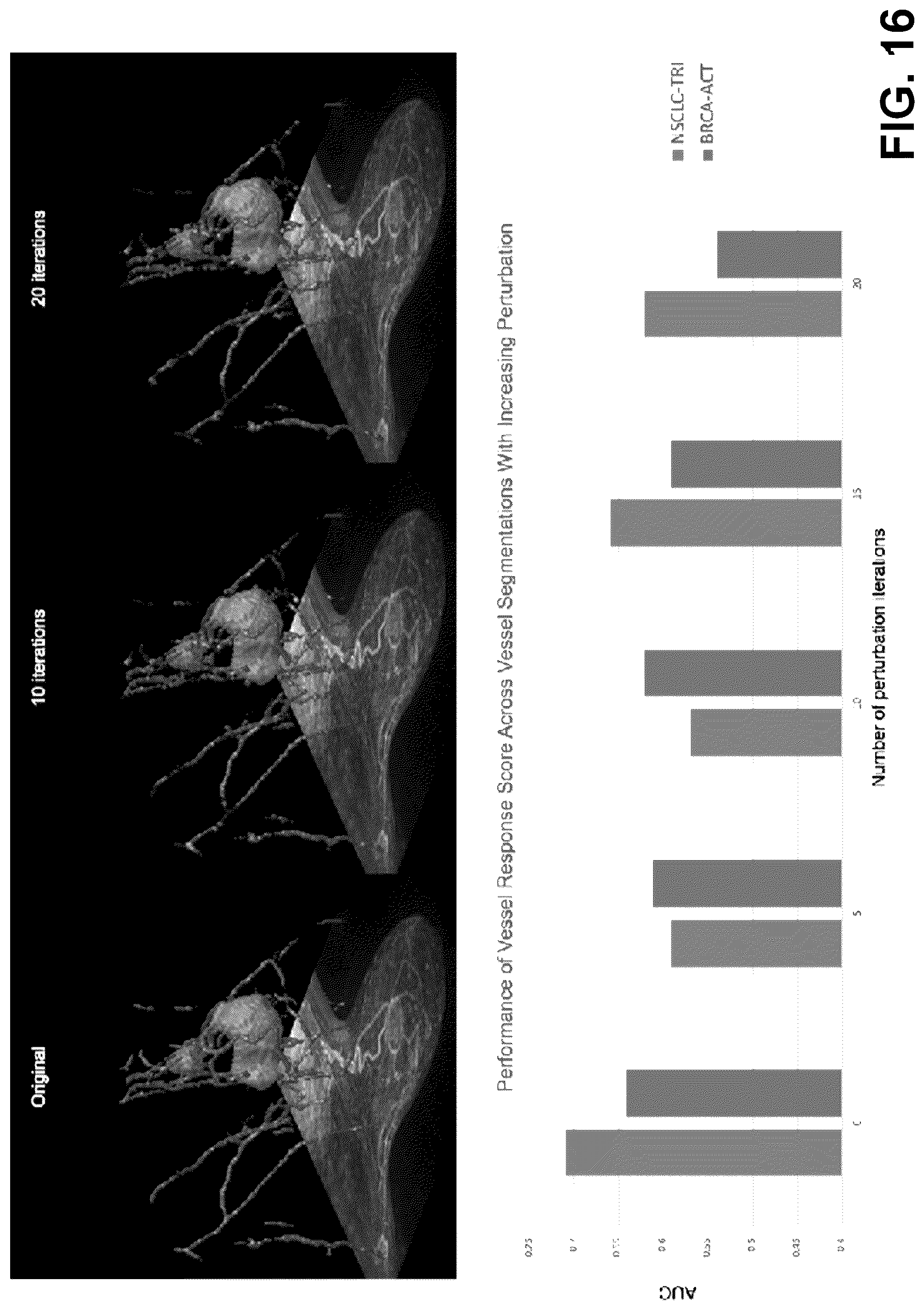 Patent US12376750 Figure 16 – Tumor characterization and outcome prediction through quantitative measurements of tumor-associated vasculature