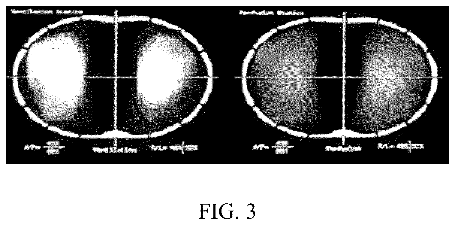 Patent US12376756 Figure 3 – Electrical impedance tomography apparatus and method