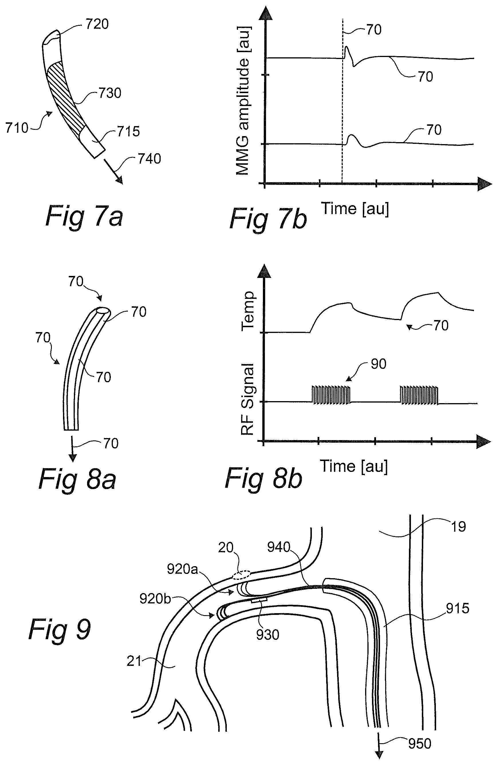 Patent US12376757 Figure 3 – Controlled sympathectomy and micro-ablation systems and methods