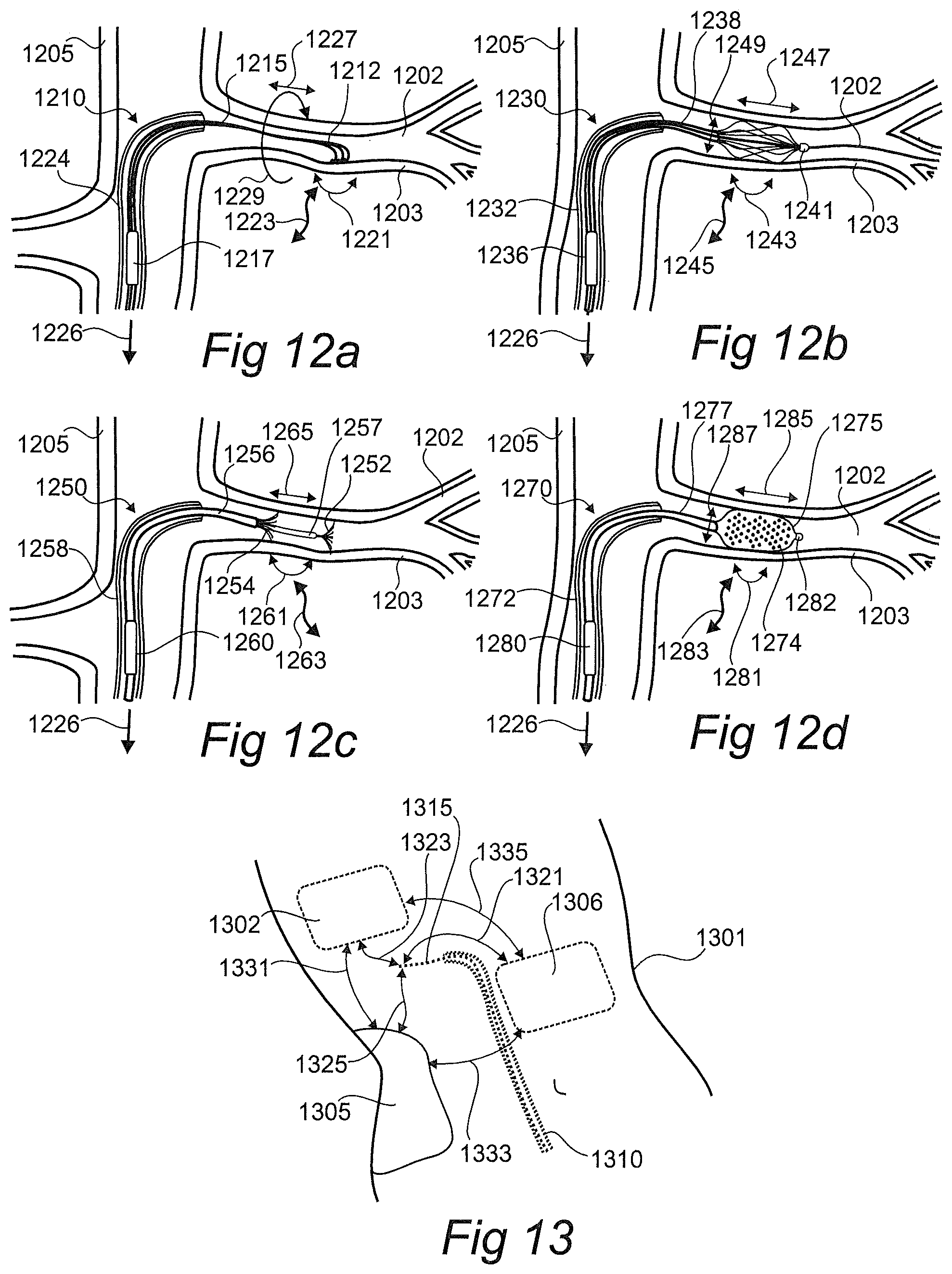 Patent US12376757 Figure 6 – Controlled sympathectomy and micro-ablation systems and methods