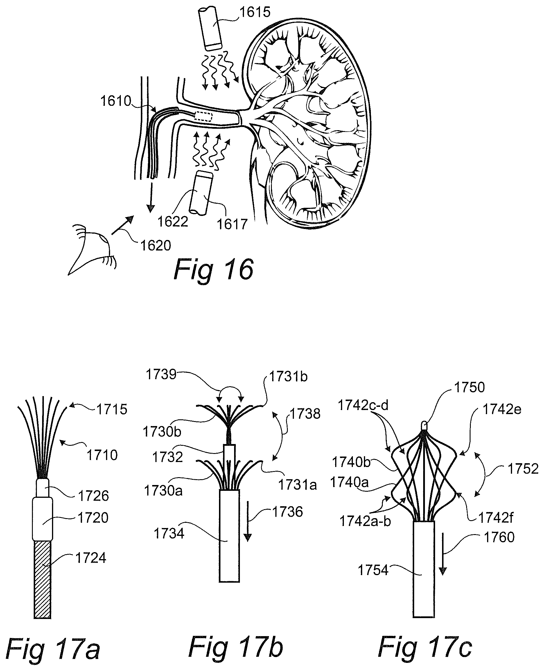 Patent US12376757 Figure 8 – Controlled sympathectomy and micro-ablation systems and methods