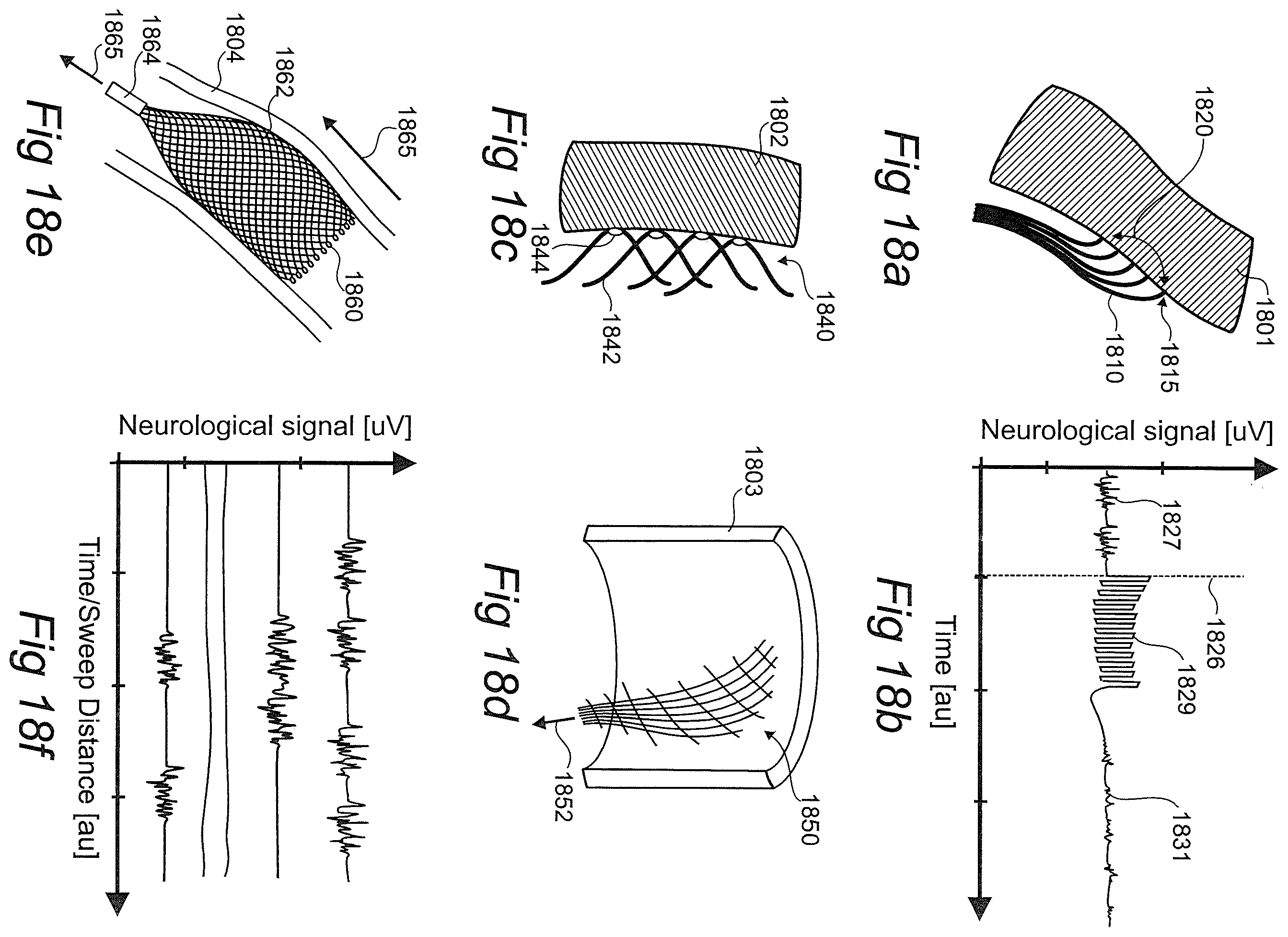 Patent US12376757 Figure 9 – Controlled sympathectomy and micro-ablation systems and methods