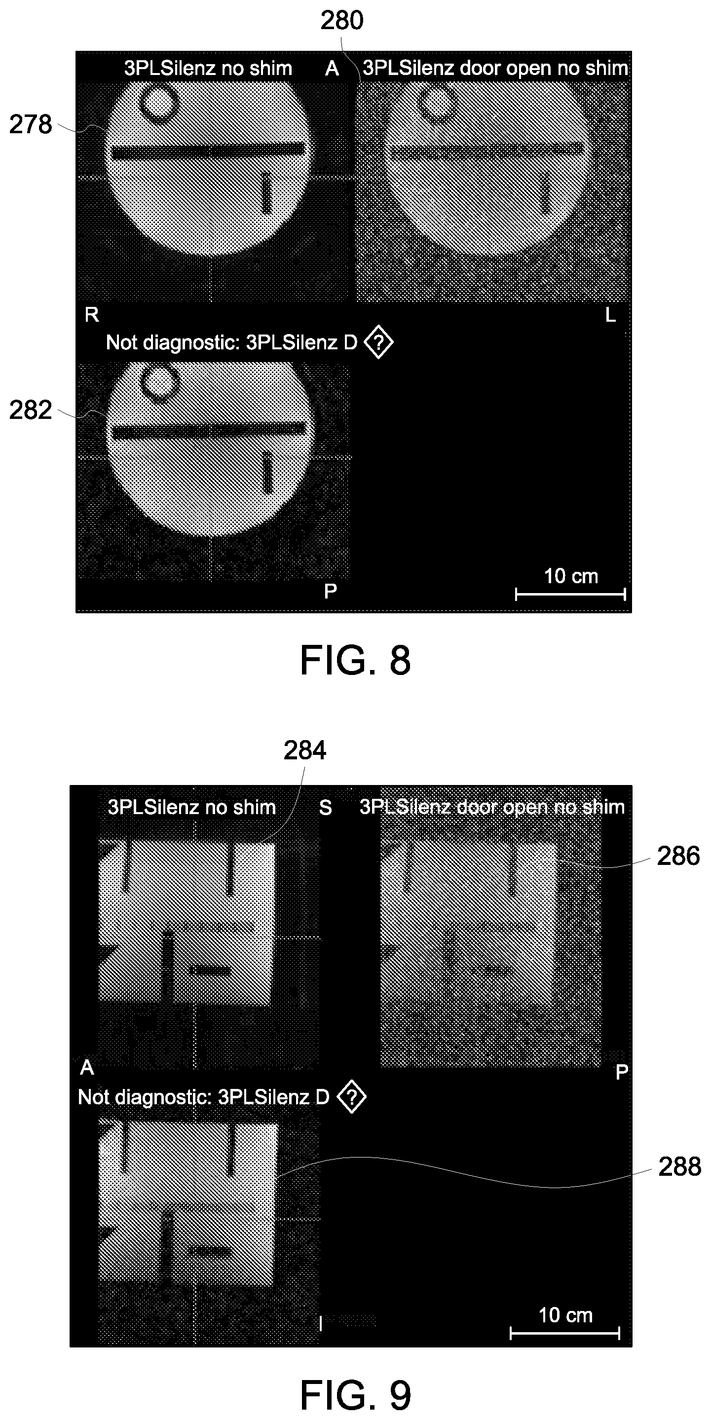 Patent US12376759 Figure 6 – System and method for improving magnetic resonance scanning workflow