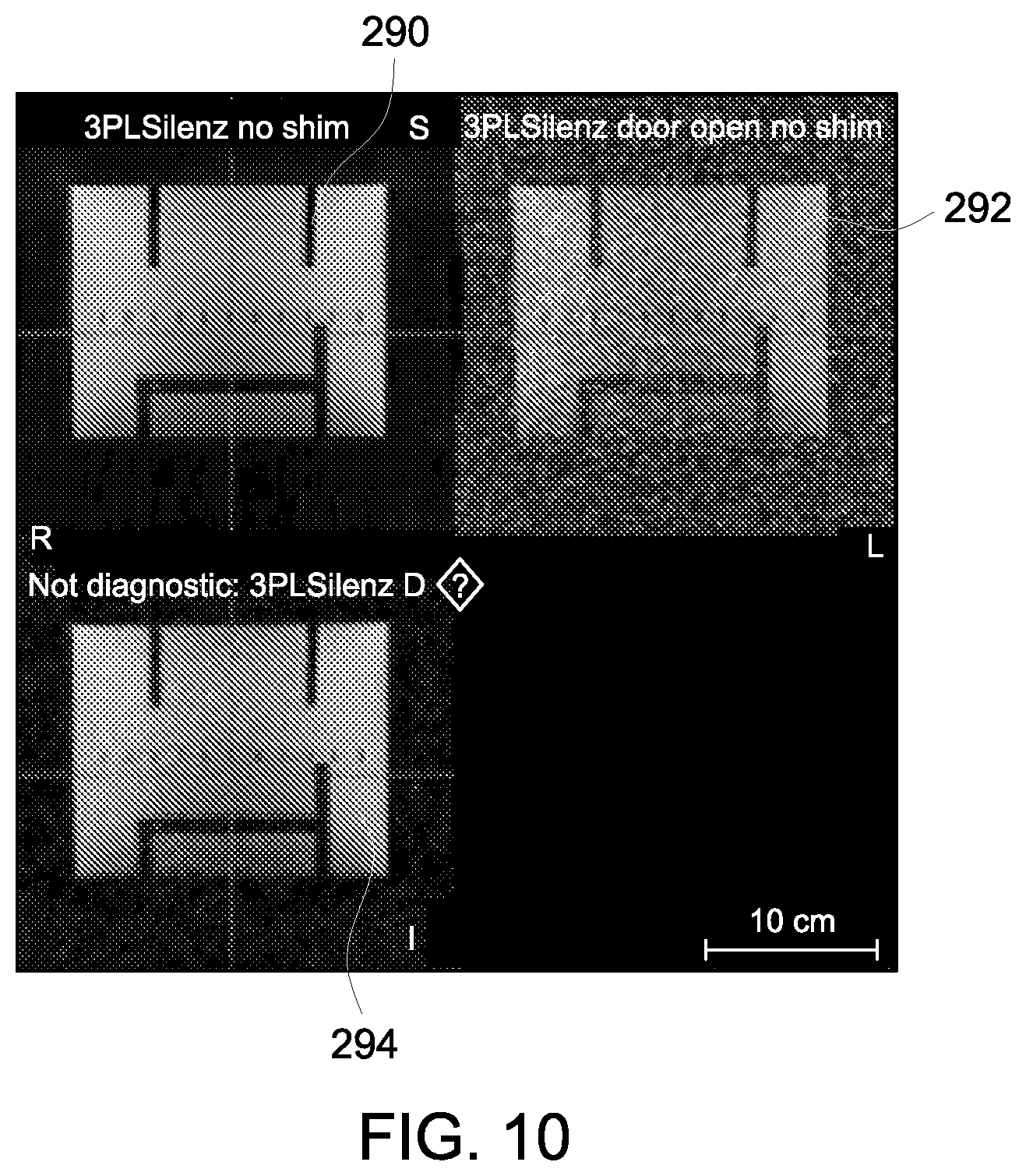 Patent US12376759 Figure 7 – System and method for improving magnetic resonance scanning workflow