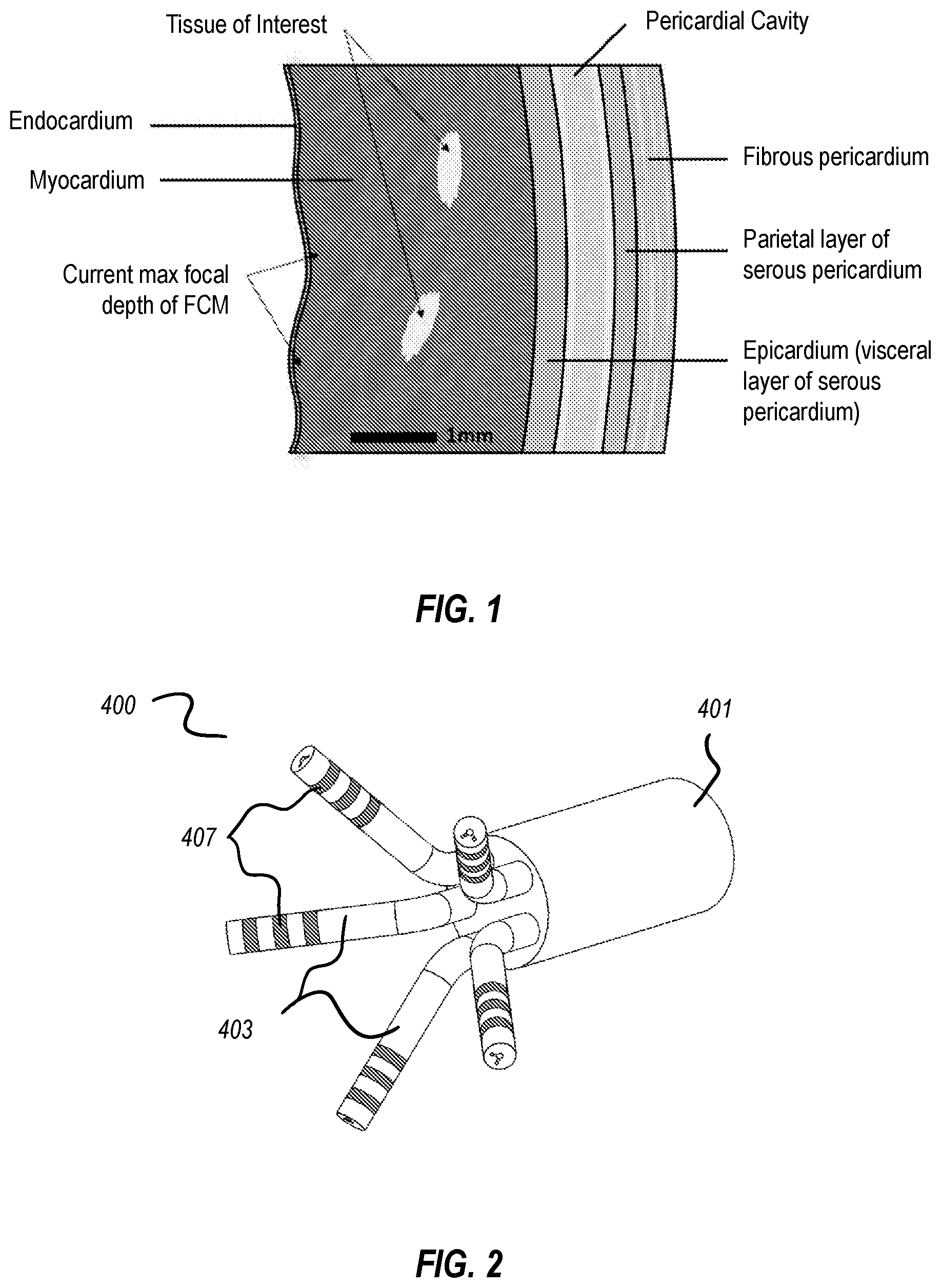 Patent US12376762 Figure 1 – Cardiac tissue characterization using catheterized light scattering spectroscopy