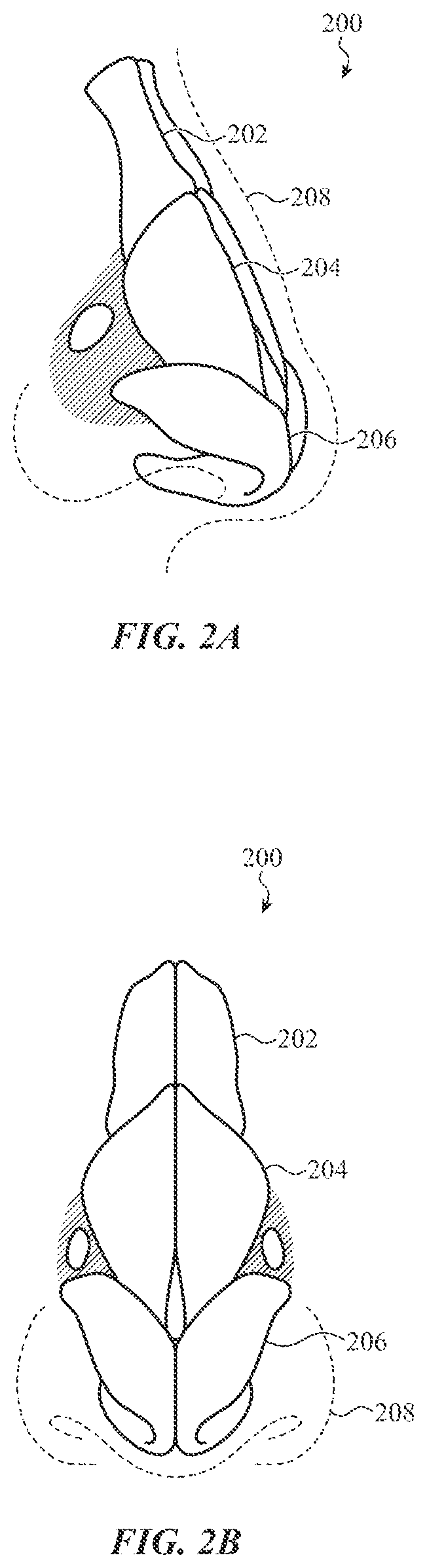 Patent US12376763 Figure 2 – Non-contact respiration sensing