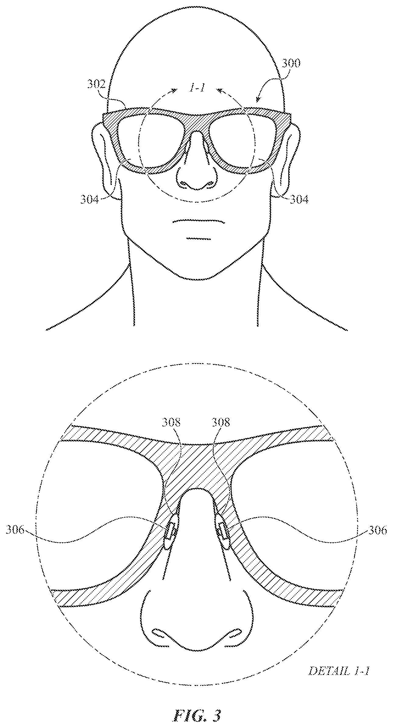 Patent US12376763 Figure 3 – Non-contact respiration sensing