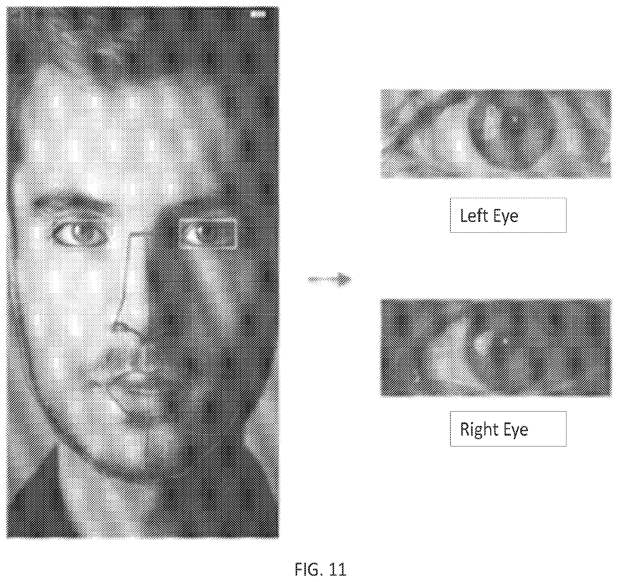 Patent US12376773 Figure 14 – Systems and methods for optical evaluation of pupillary psychosensory responses