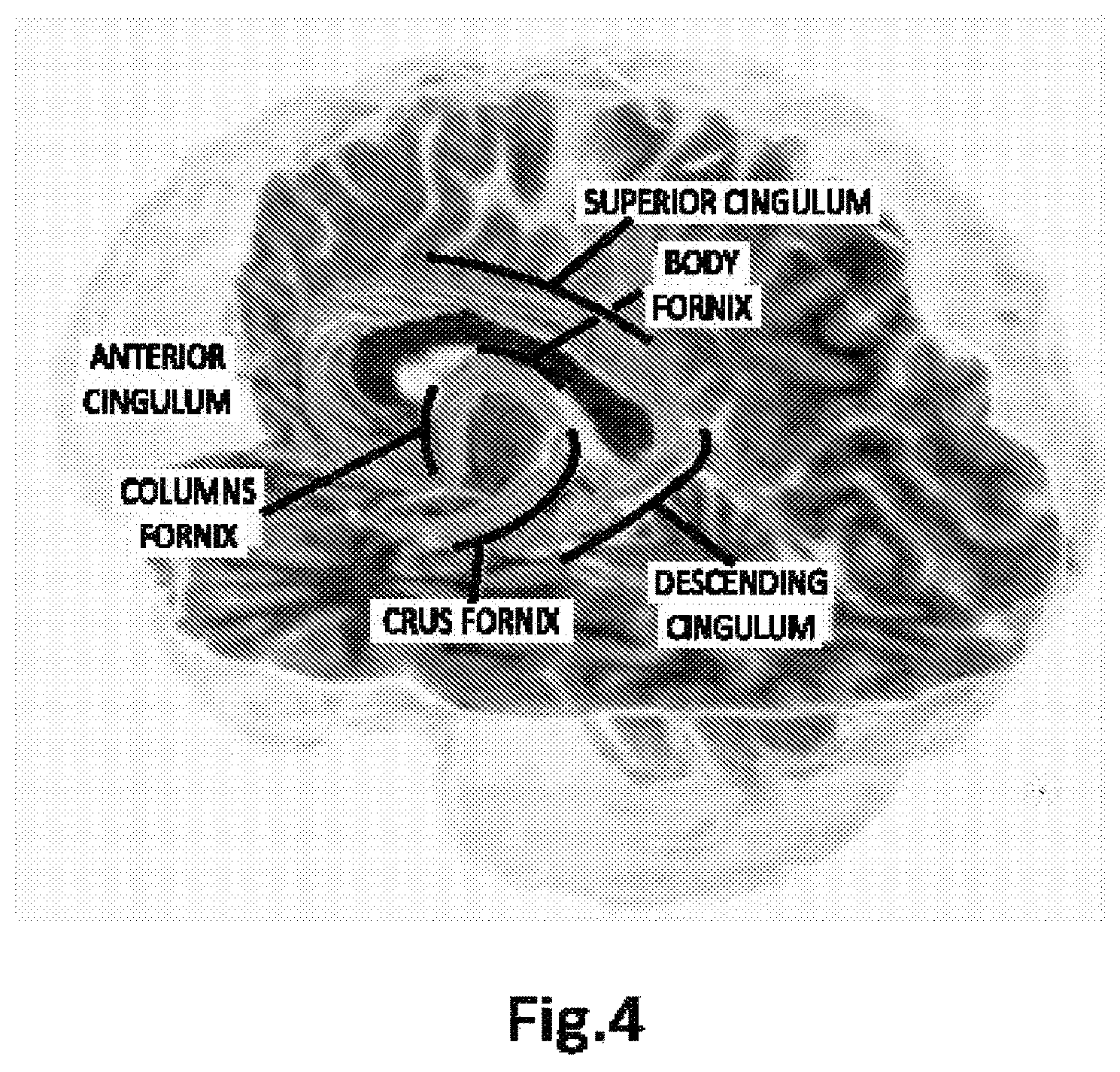 Patent US12376775 Figure 3 – Identifying and strengthening physiological/neurophysiological states predictive of superior performance