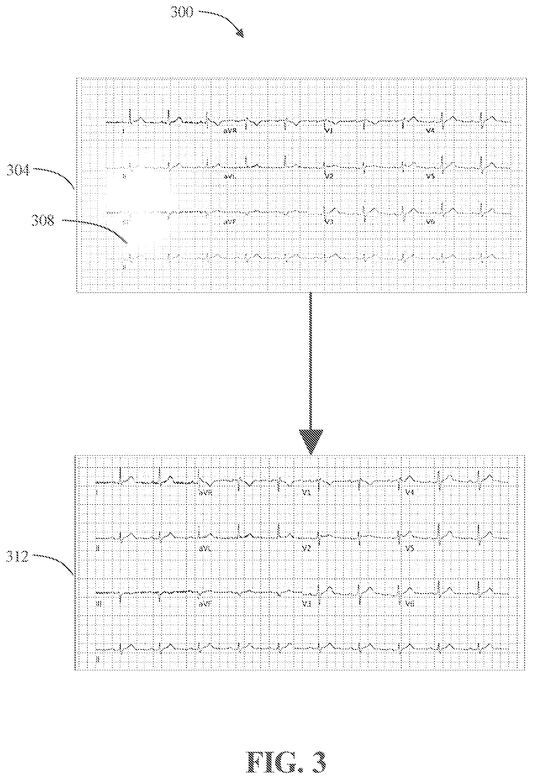 Patent US12376777 Figure 3 – Systems and methods for transforming electrocardiogram images for use in one or more machine learning models