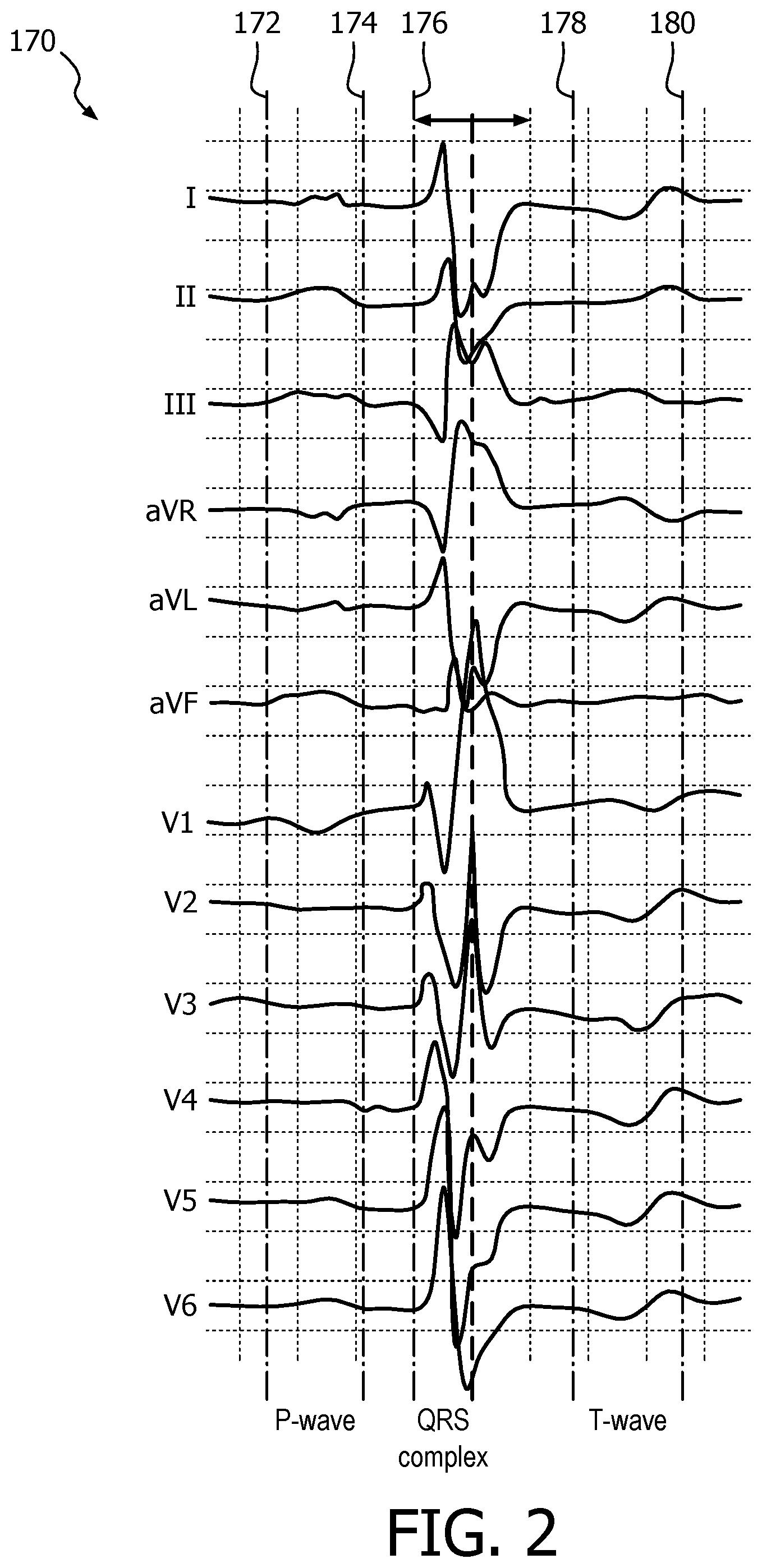 Patent US12376778 Figure 2 – ECG features for type ahead editing and automatic update for report interpretation