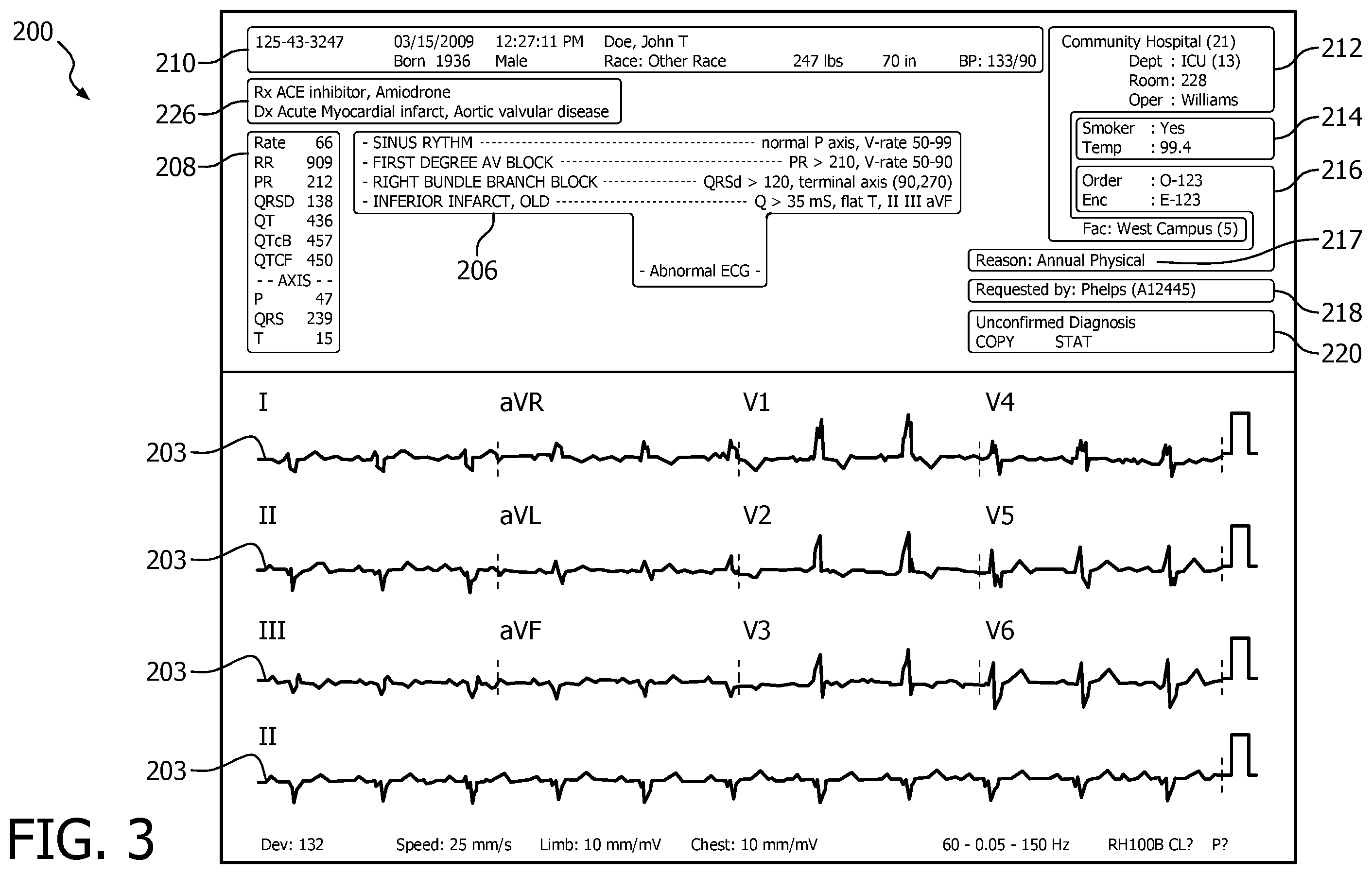 Patent US12376778 Figure 3 – ECG features for type ahead editing and automatic update for report interpretation