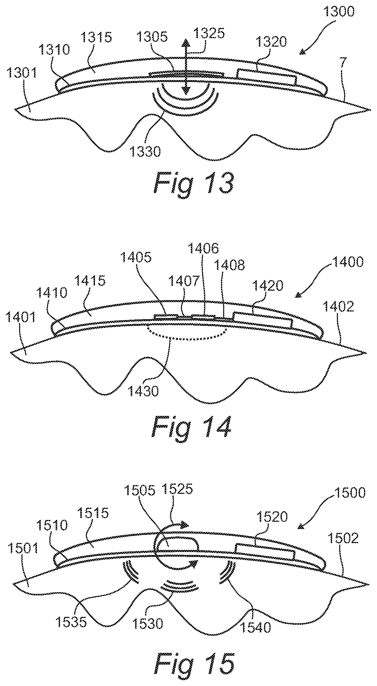 Patent US12376782 Figure 8 – Modular physiologic monitoring systems, kits, and methods