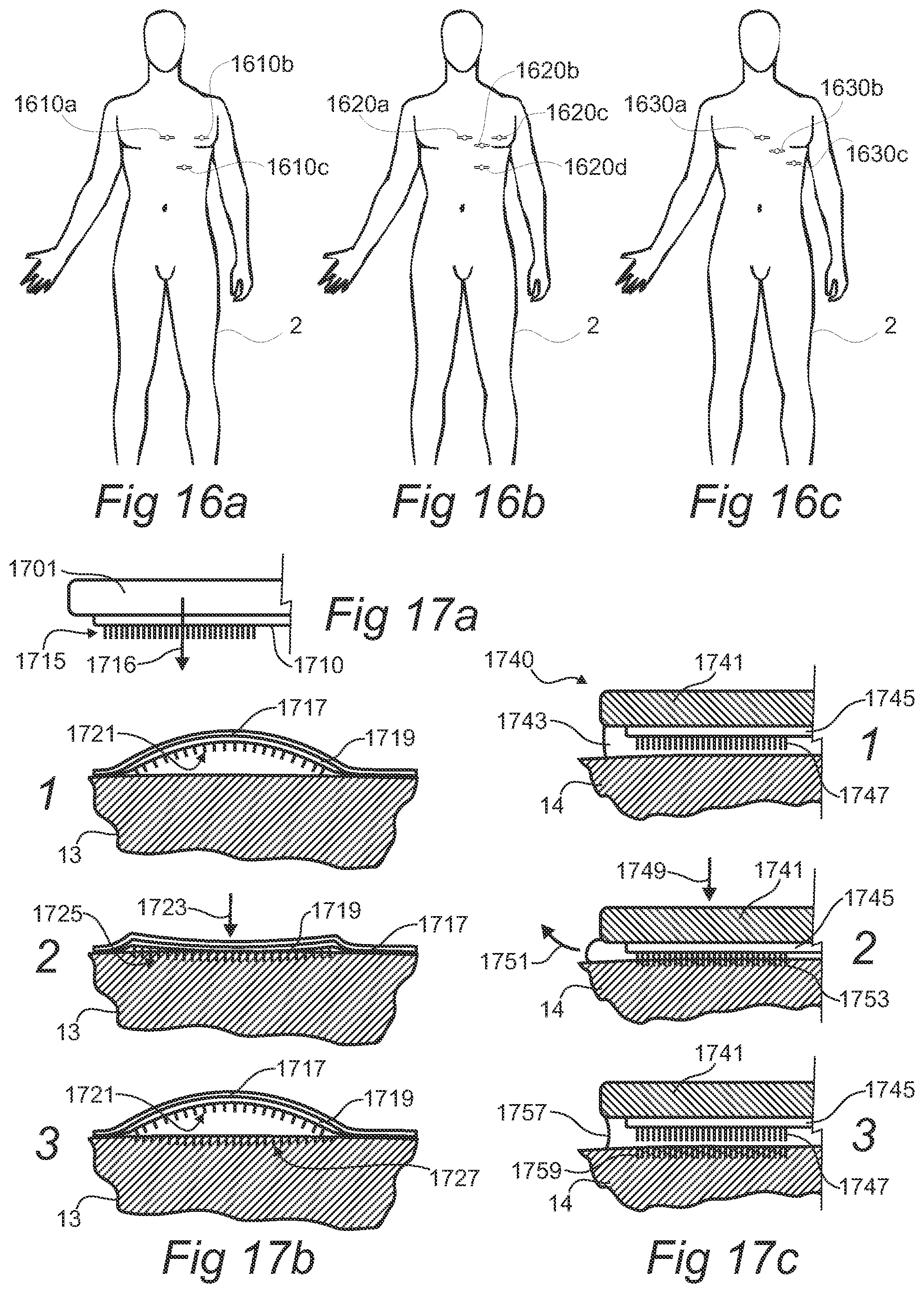 Patent US12376782 Figure 9 – Modular physiologic monitoring systems, kits, and methods