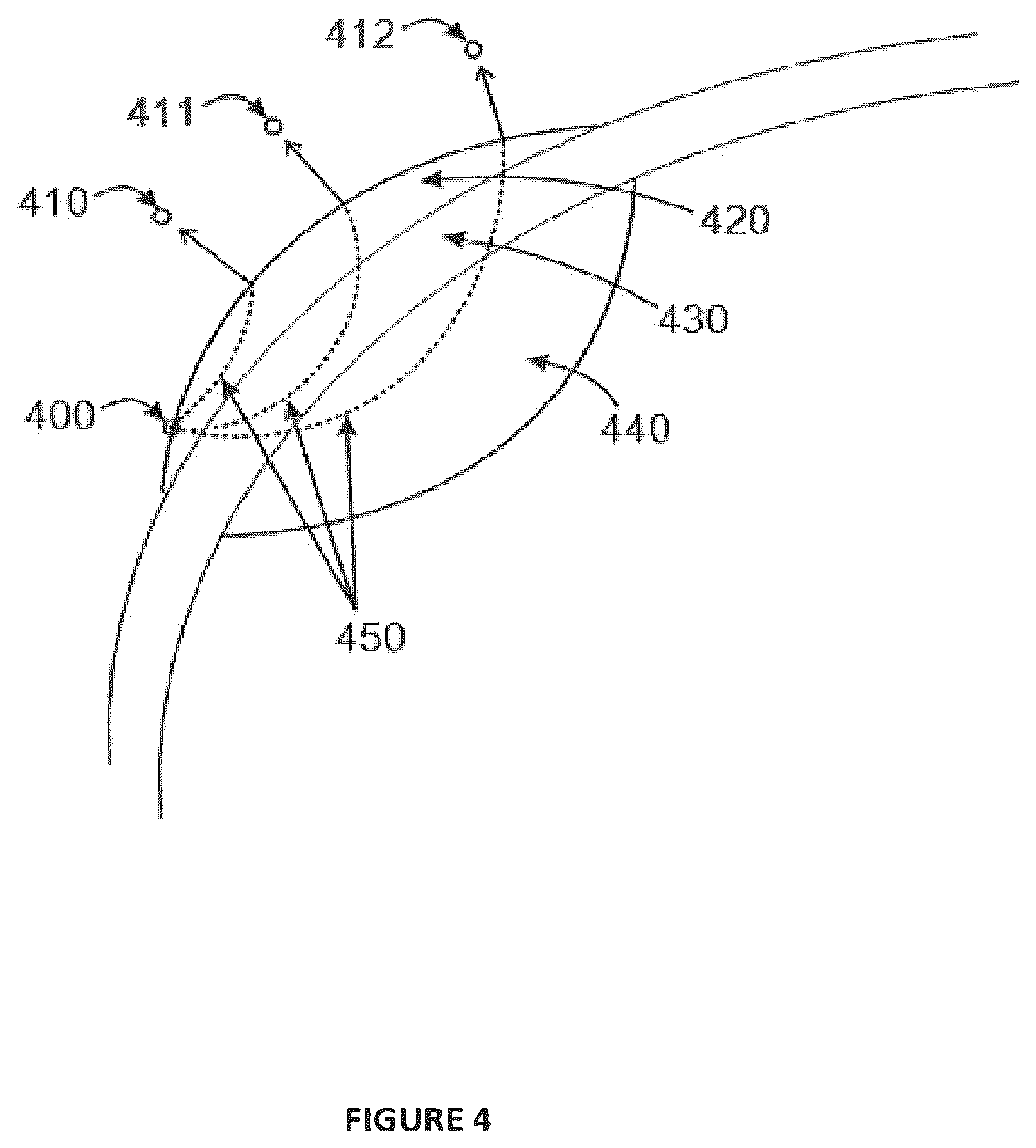 Patent US12376783 Figure 5 – Apparatus of intracranial imaging