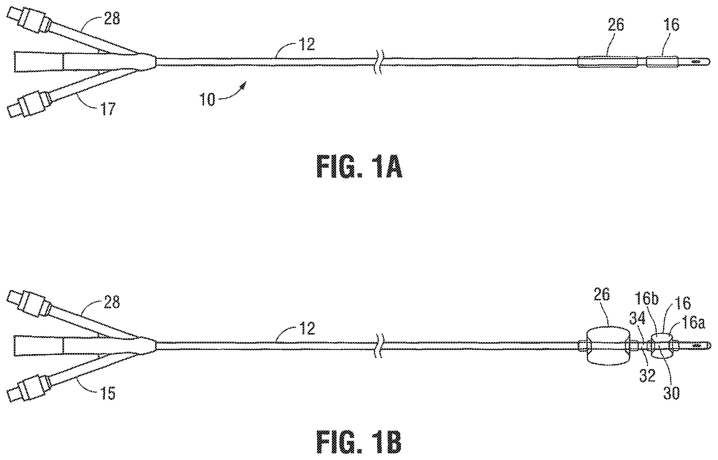 Patent US12376785 — Catheter for monitoring intra-abdominal pressure for assessing preeclampsia — Figure 1