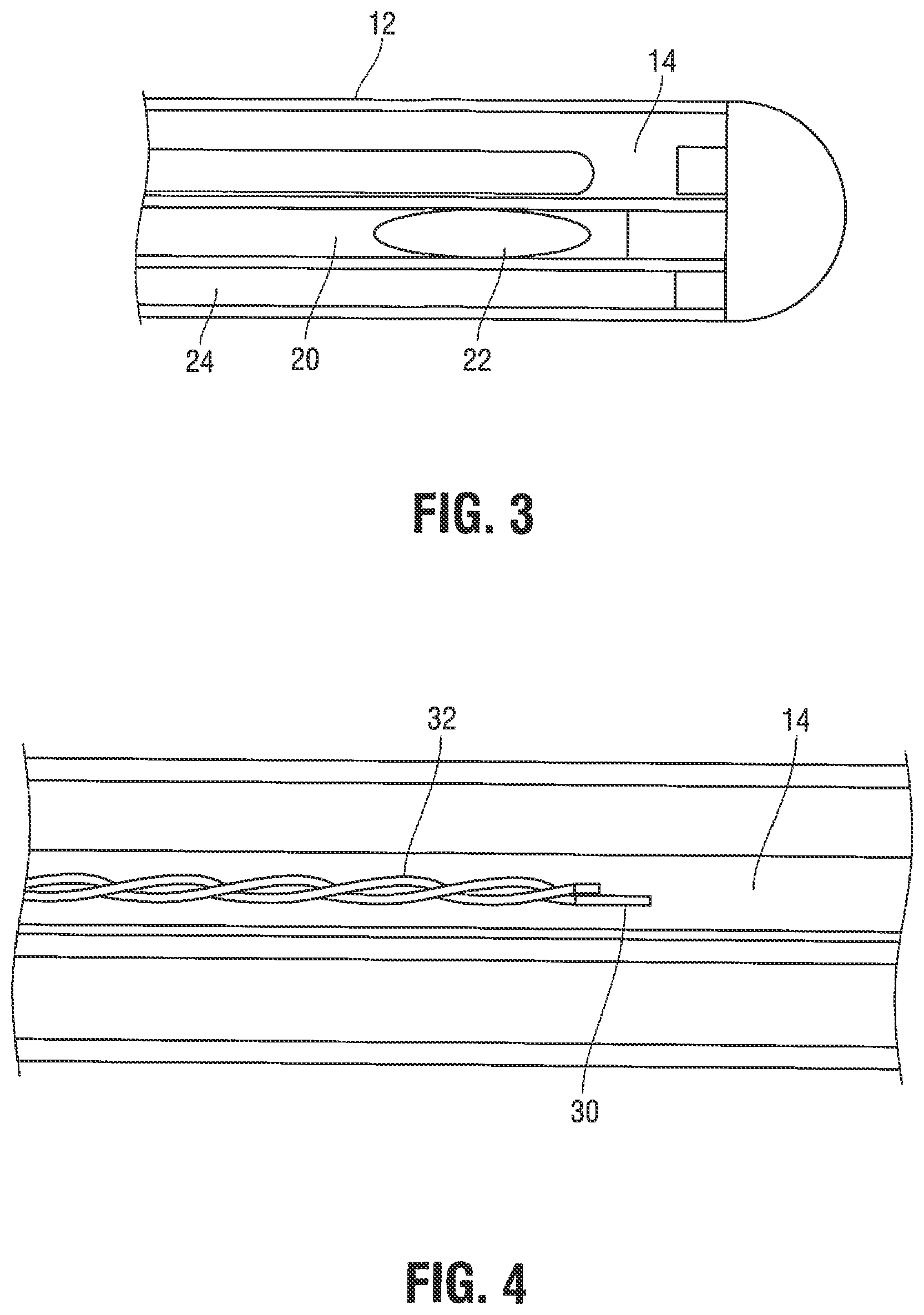 Patent US12376785 Figure 3 – Catheter for monitoring intra-abdominal pressure for assessing preeclampsia
