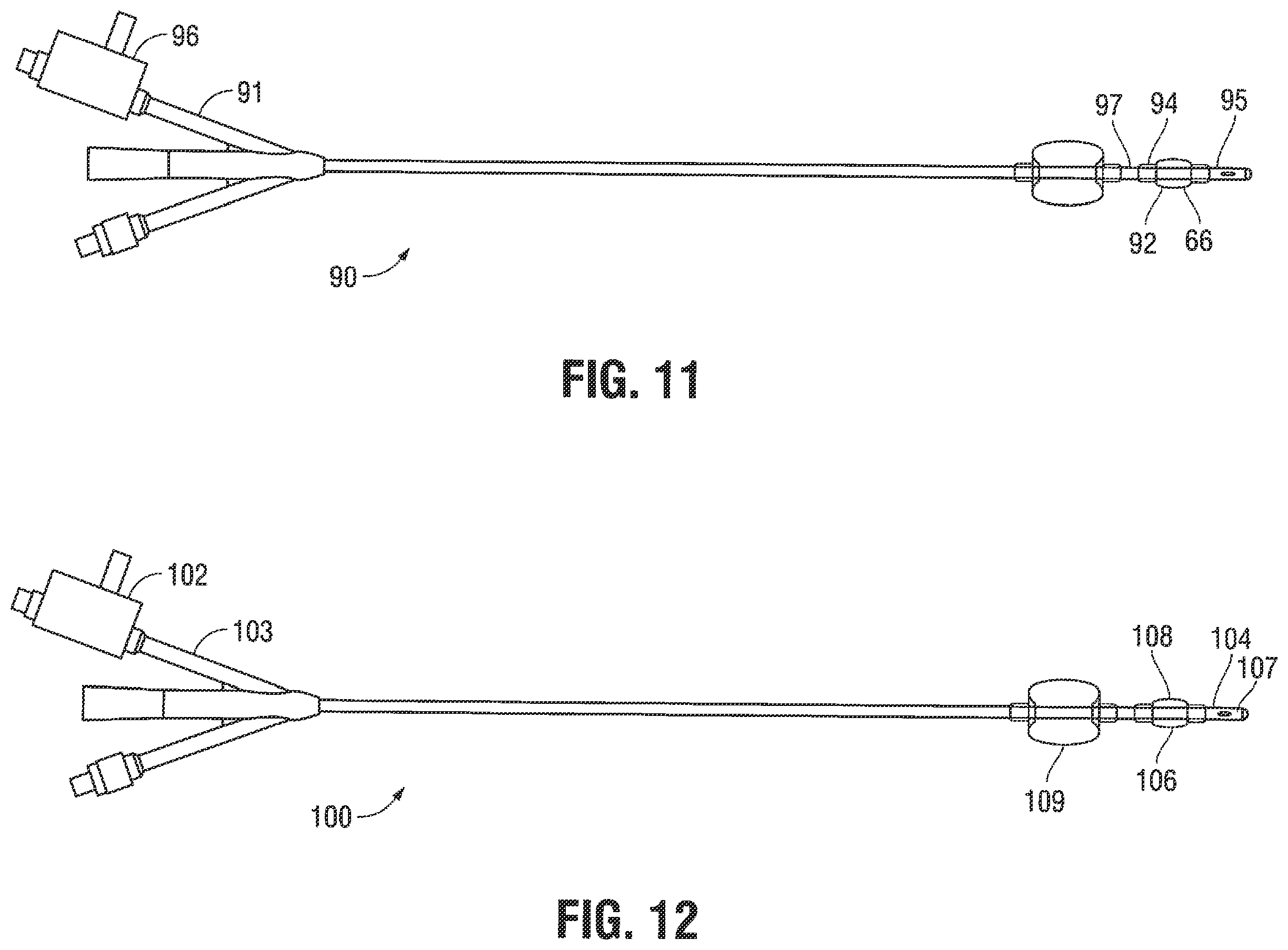 Patent US12376785 Figure 8 – Catheter for monitoring intra-abdominal pressure for assessing preeclampsia
