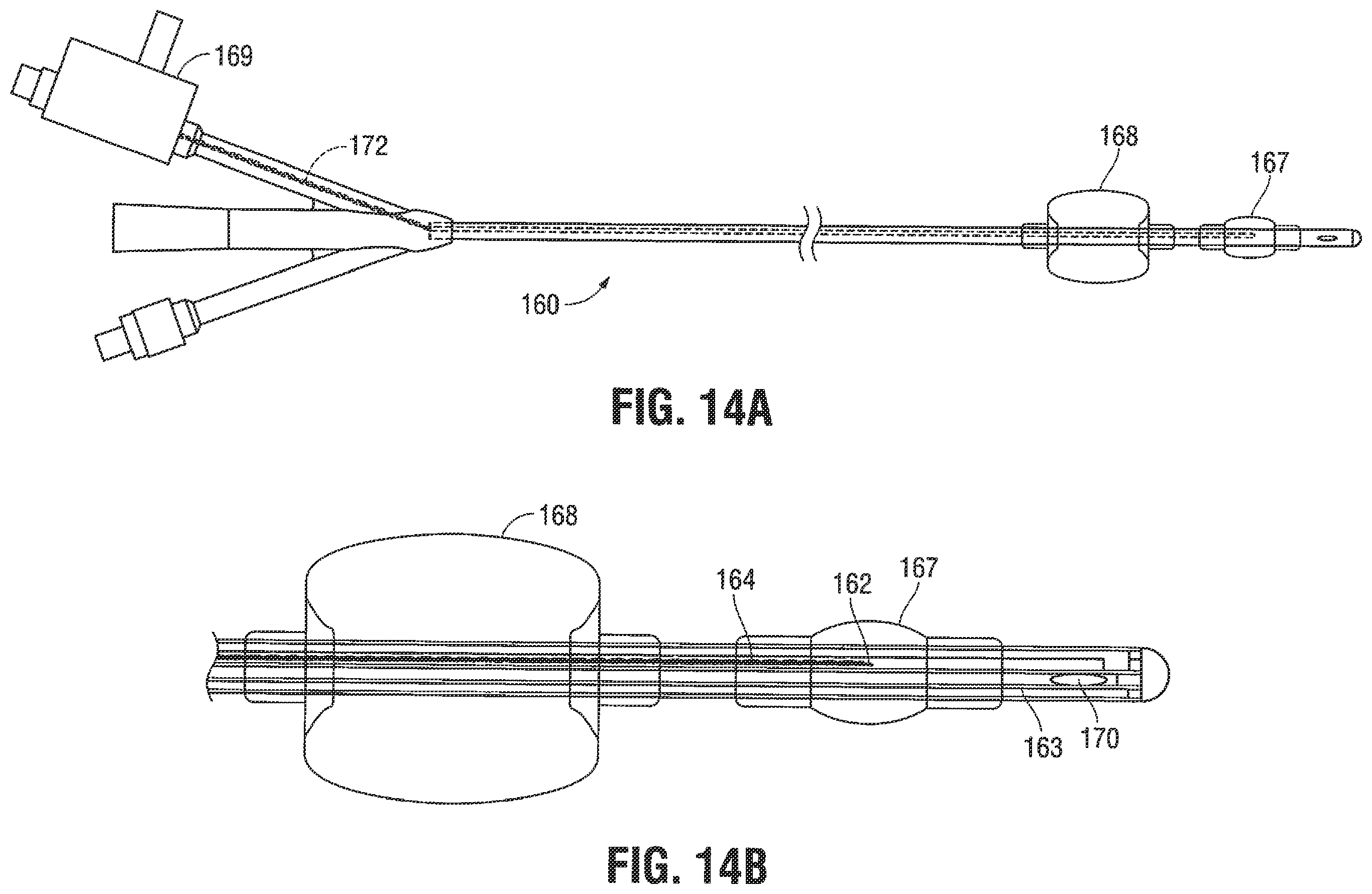 Patent US12376785 Figure 10 – Catheter for monitoring intra-abdominal pressure for assessing preeclampsia