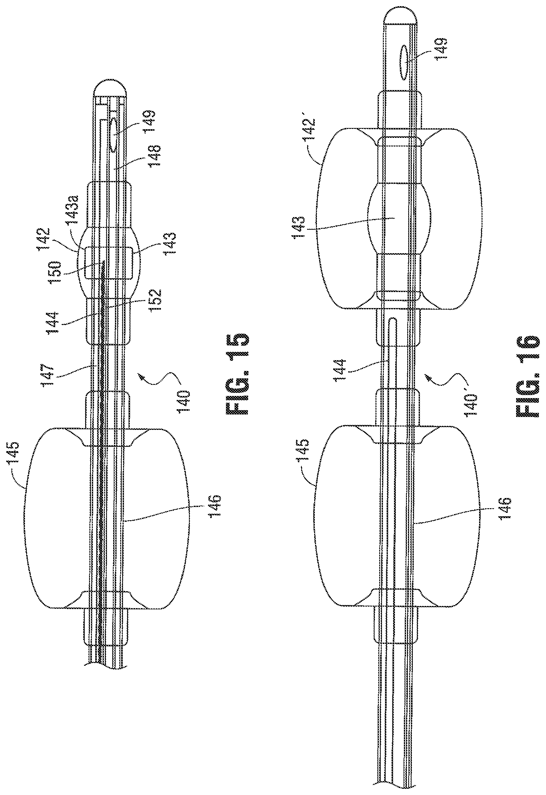 Patent US12376785 Figure 11 – Catheter for monitoring intra-abdominal pressure for assessing preeclampsia