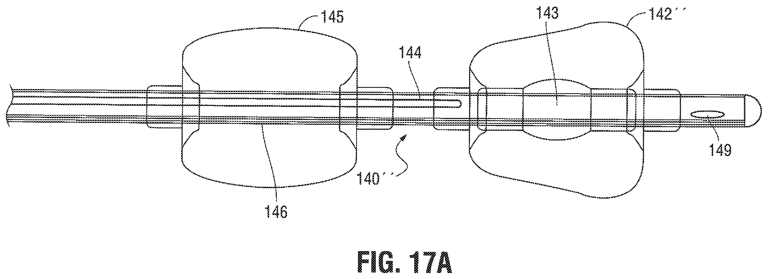 Patent US12376785 Figure 12 – Catheter for monitoring intra-abdominal pressure for assessing preeclampsia