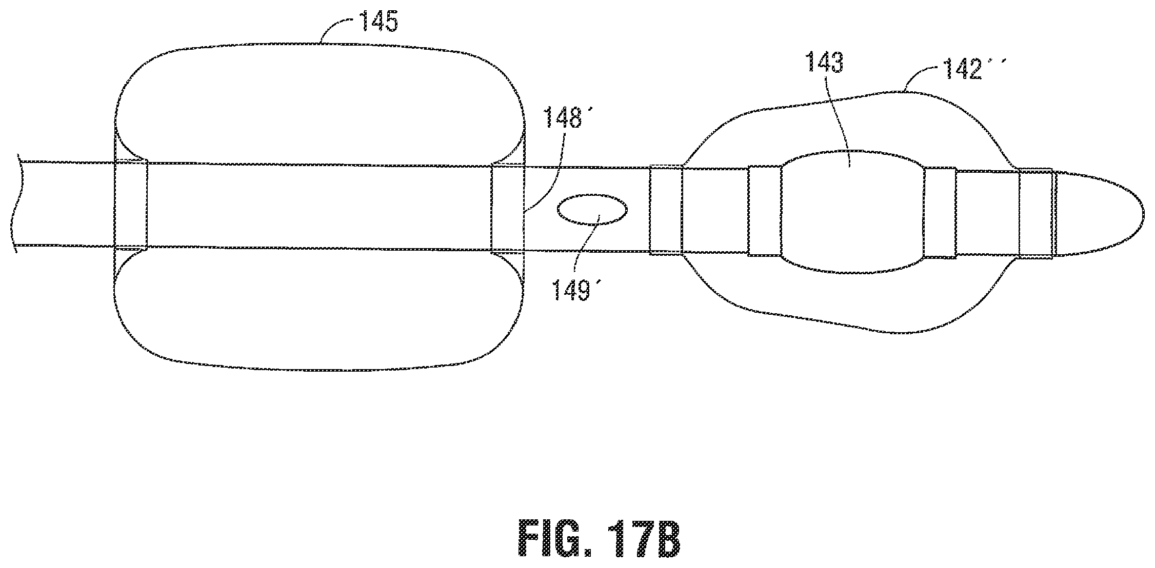 Patent US12376785 Figure 13 – Catheter for monitoring intra-abdominal pressure for assessing preeclampsia