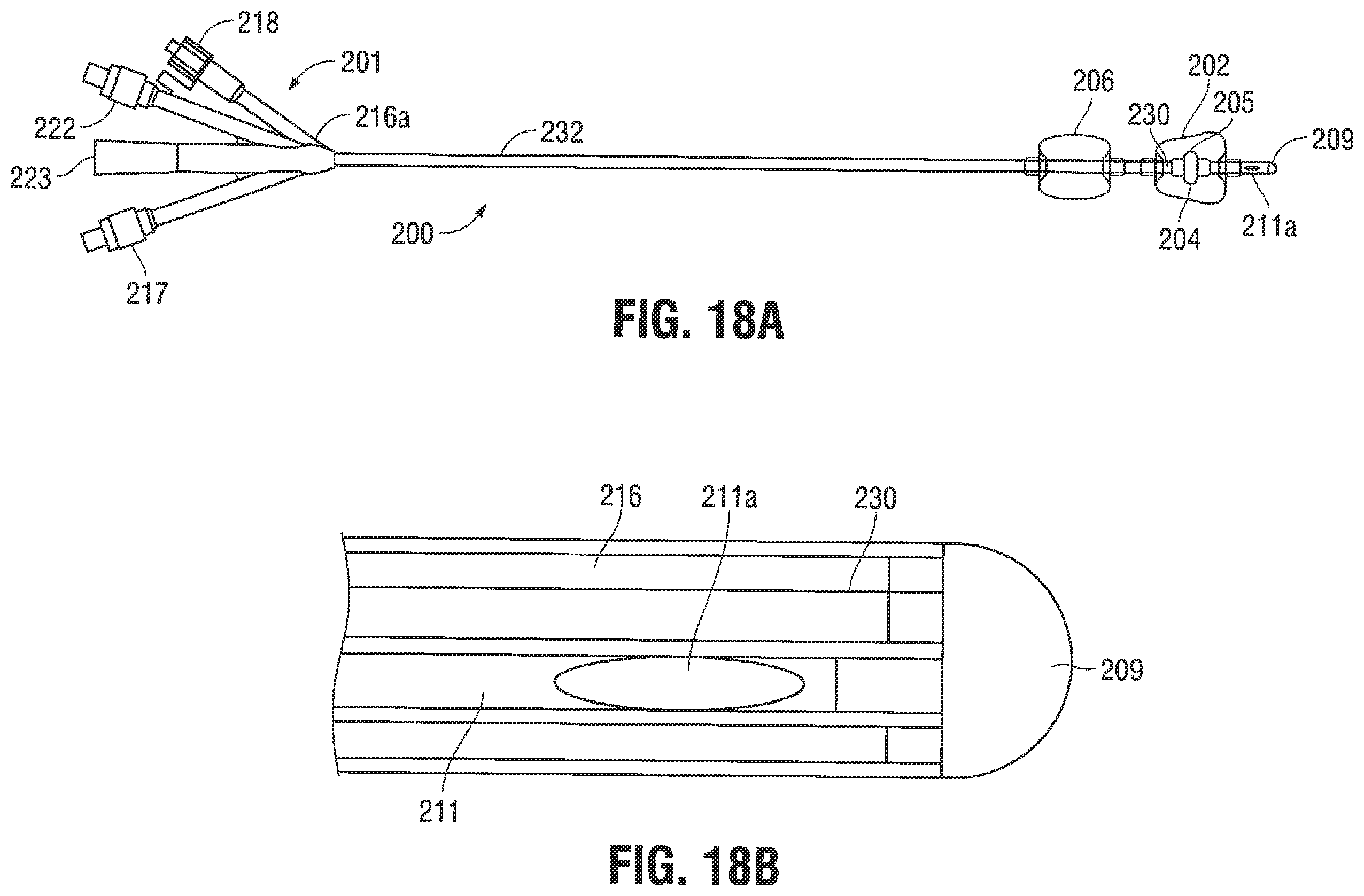 Patent US12376785 Figure 14 – Catheter for monitoring intra-abdominal pressure for assessing preeclampsia