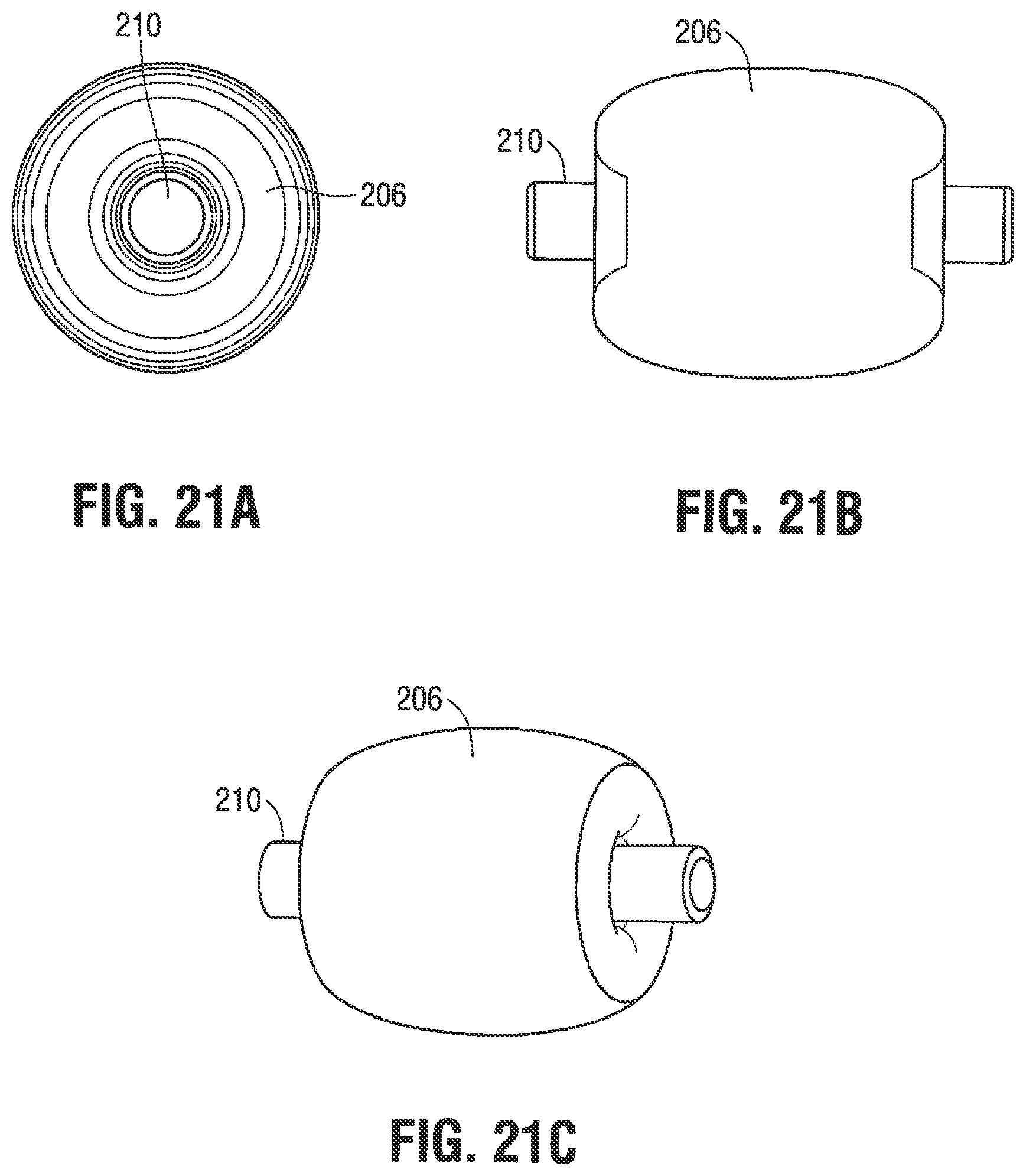 Patent US12376785 Figure 17 – Catheter for monitoring intra-abdominal pressure for assessing preeclampsia