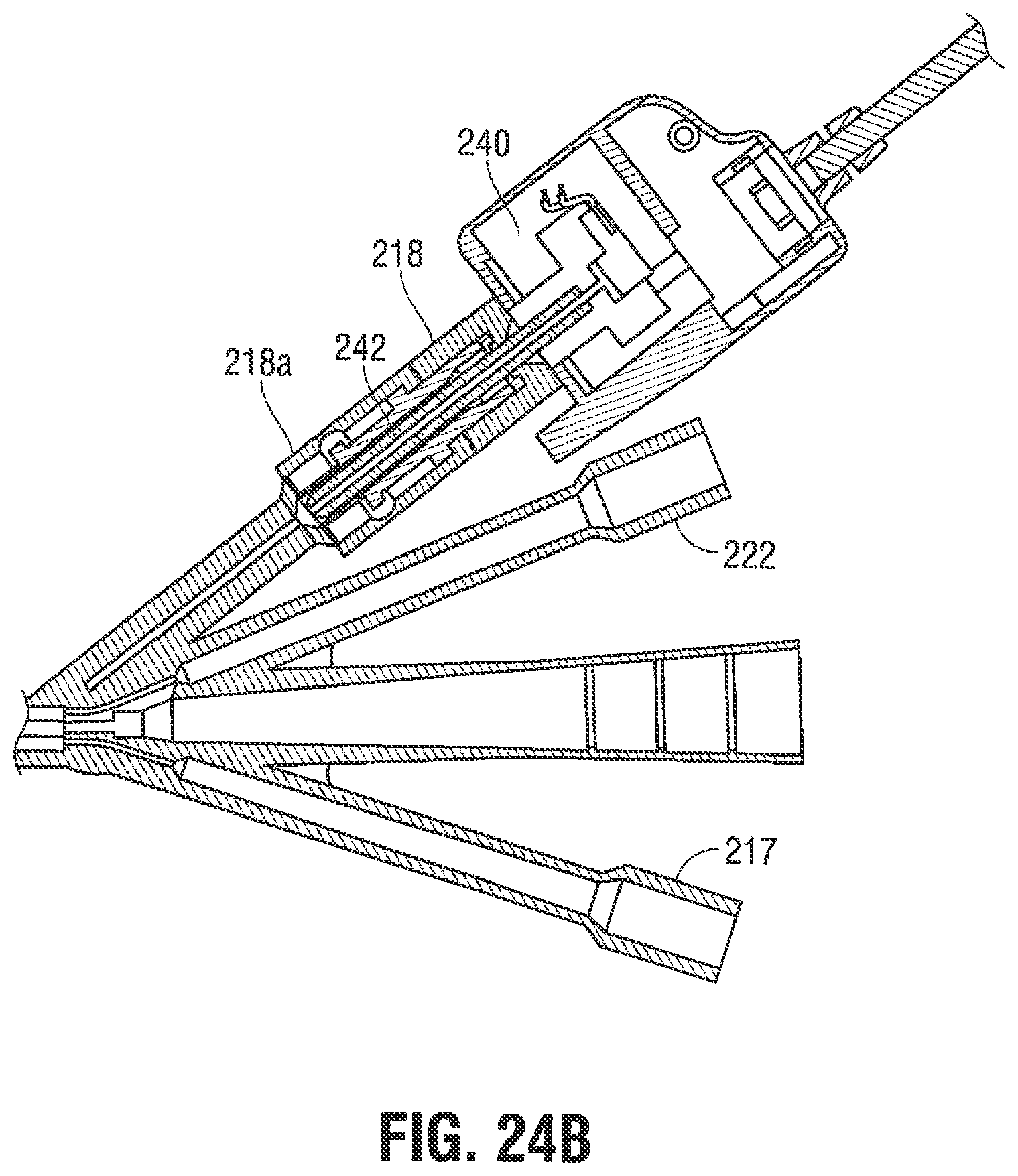 Patent US12376785 Figure 20 – Catheter for monitoring intra-abdominal pressure for assessing preeclampsia