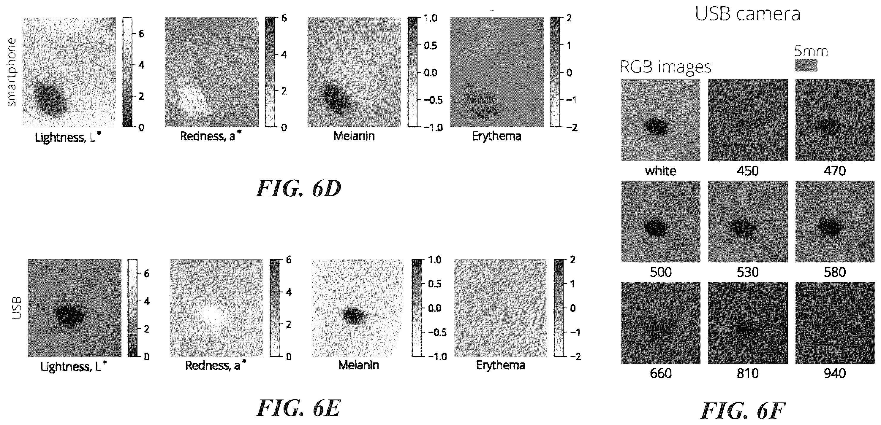 Patent US12376786 Figure 9 – Smartphone-based multispectral dermascope