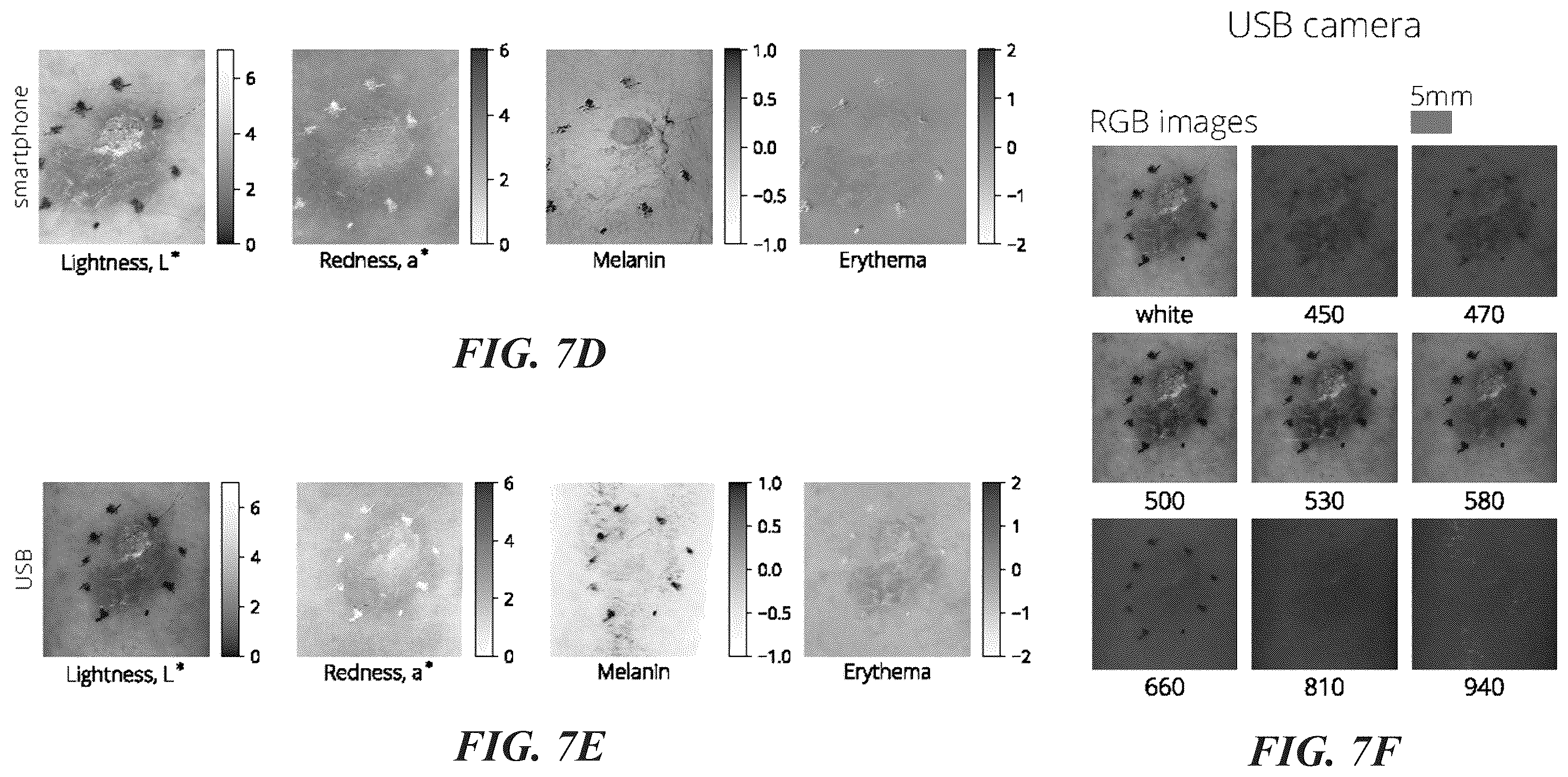 Patent US12376786 Figure 11 – Smartphone-based multispectral dermascope