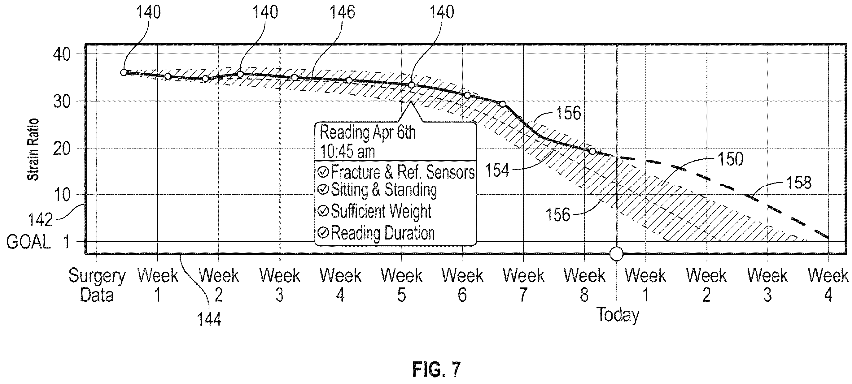 Patent US12376787 Figure 7 – Bone fixation monitoring system