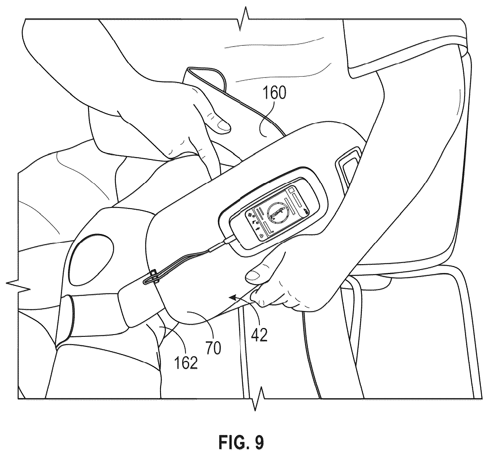 Patent US12376787 Figure 9 – Bone fixation monitoring system
