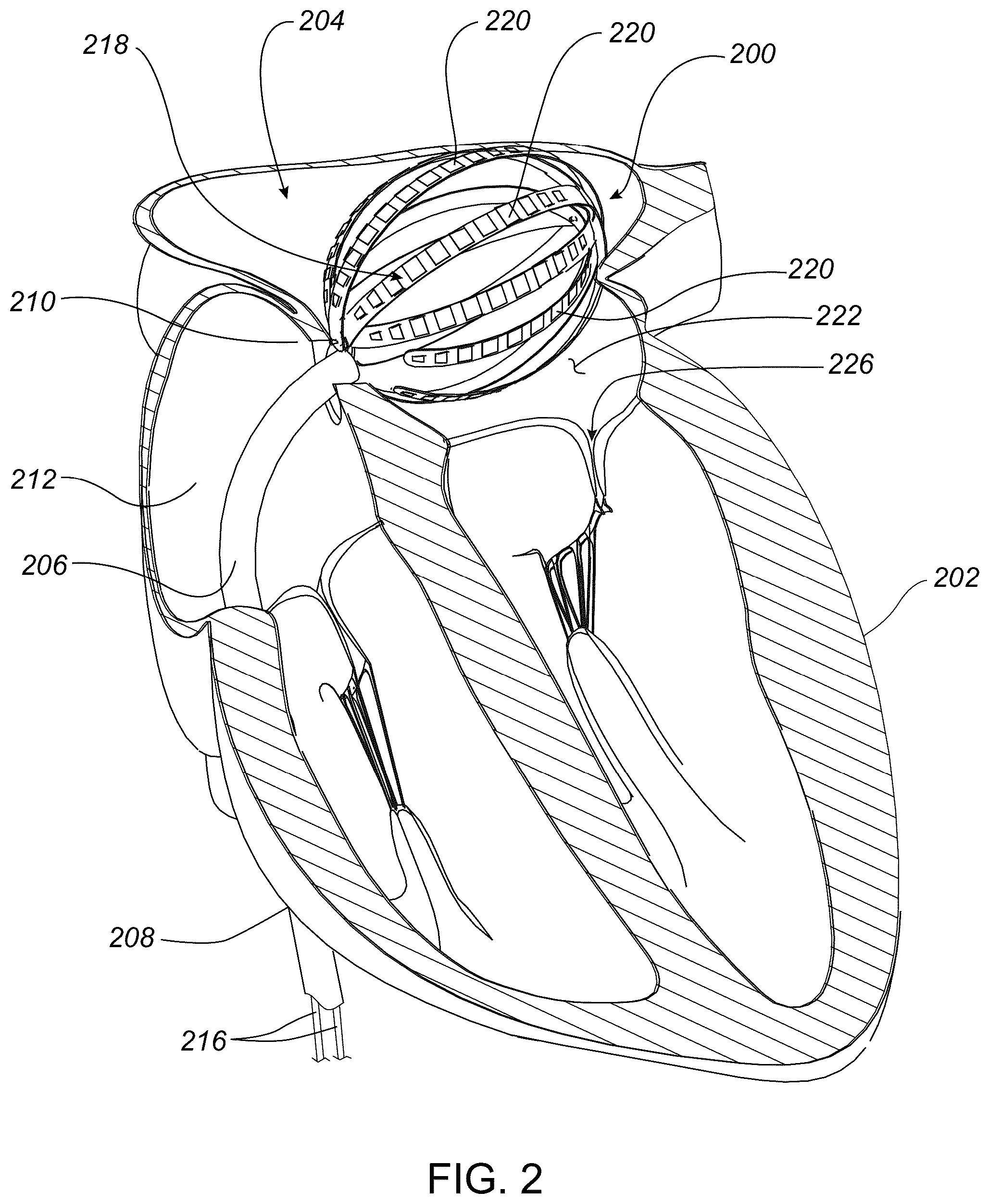 Patent US12376795 Figure 2 – Systems and methods for activating transducers