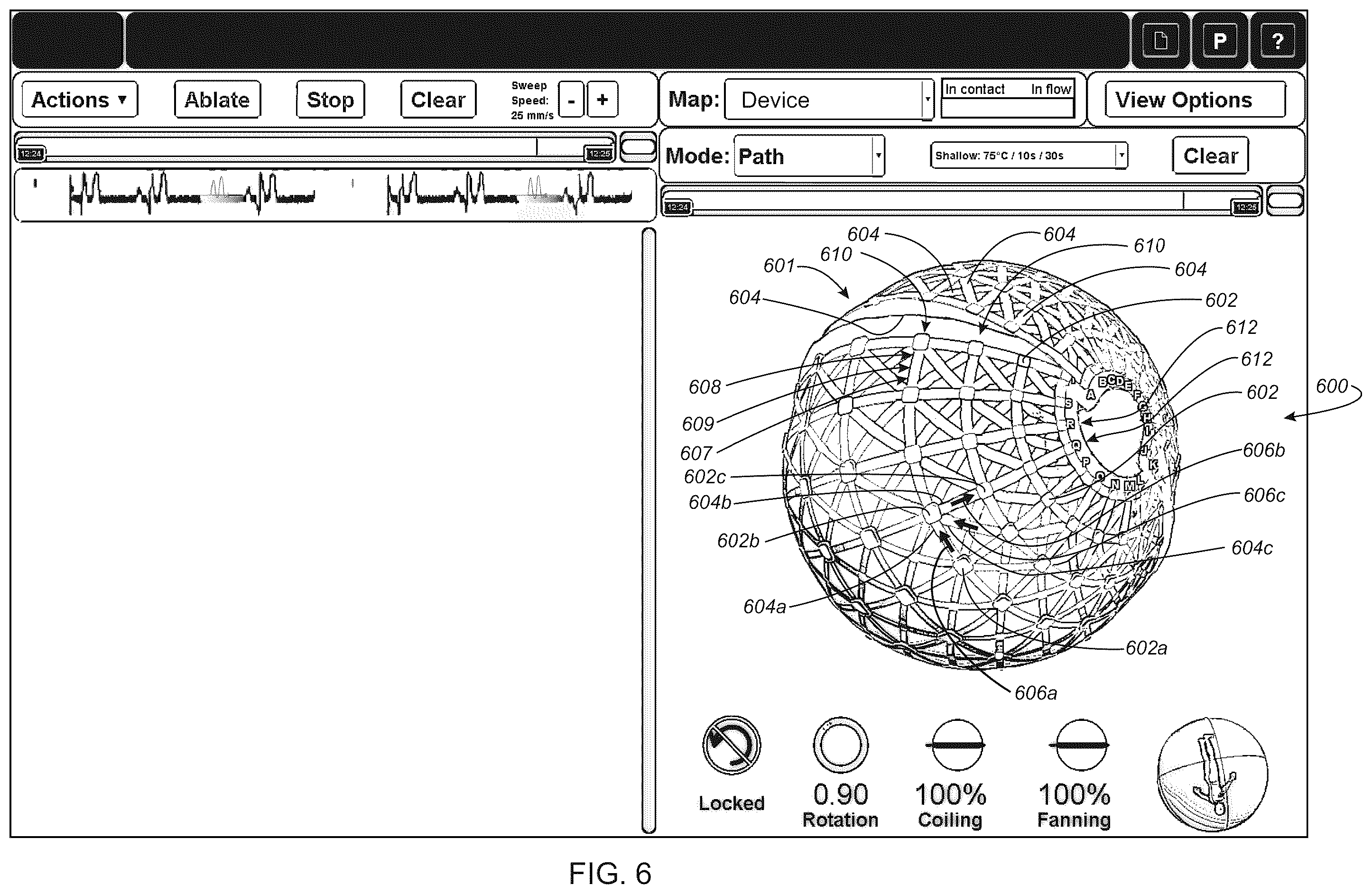 Patent US12376795 Figure 17 – Systems and methods for activating transducers