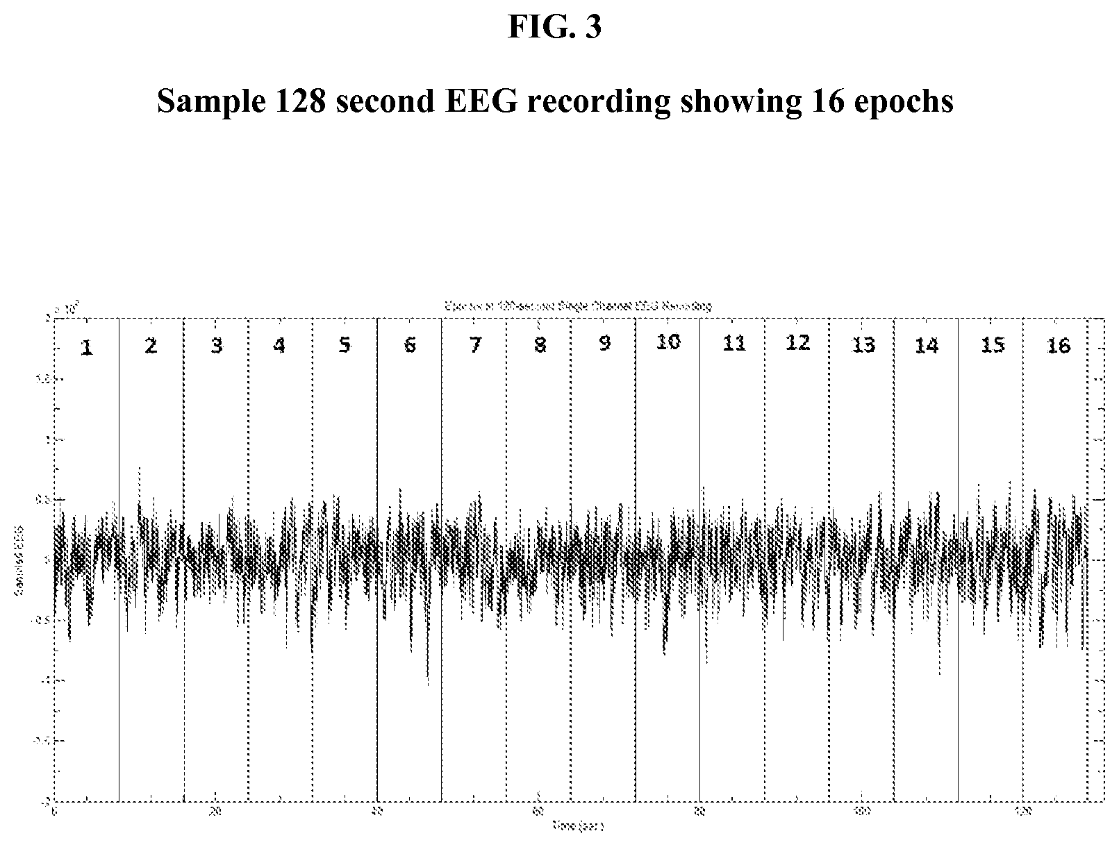 Patent US12376800 Figure 3 – Method and device for determining a valid intrinsic frequency