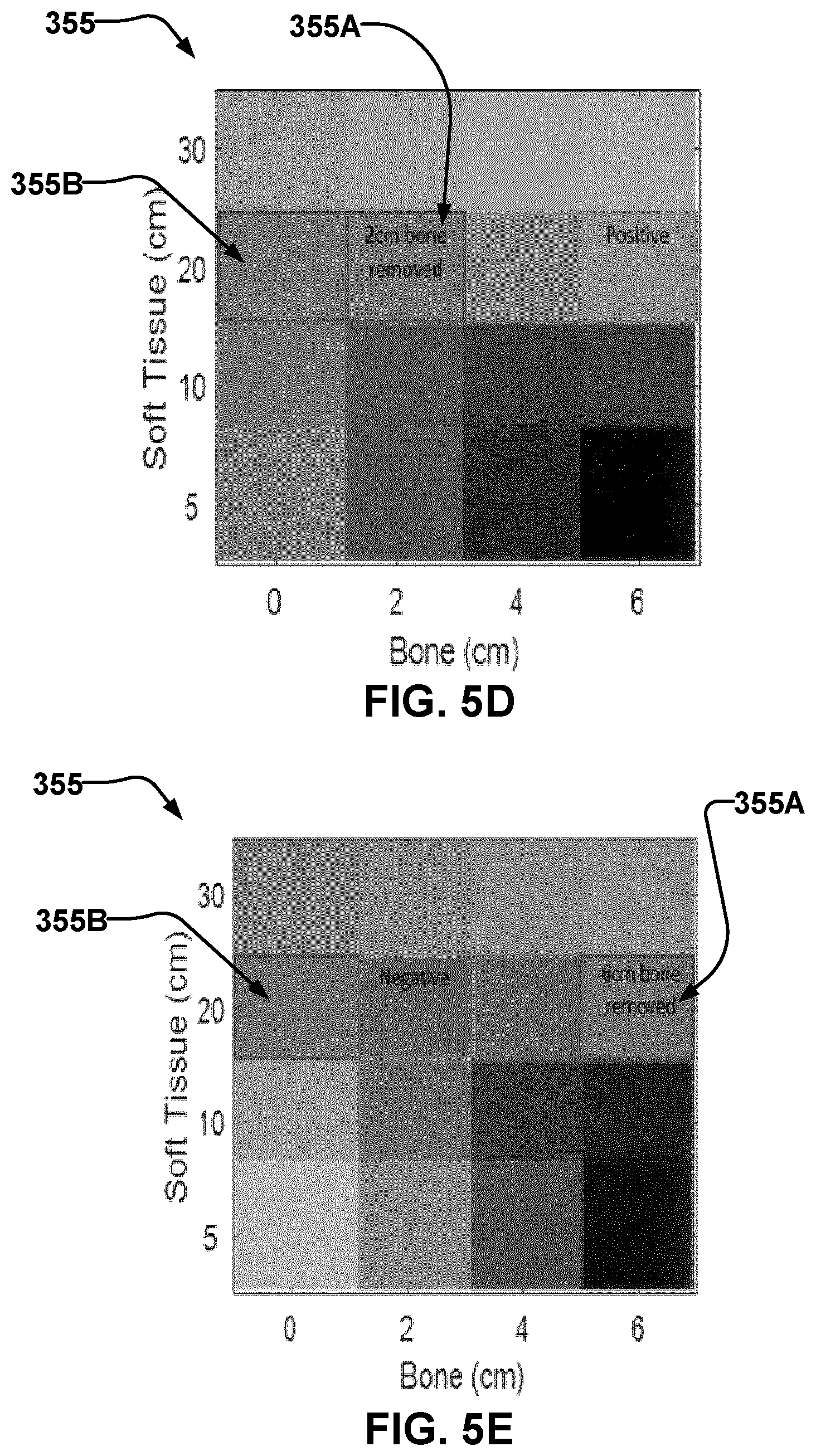 Patent US12376812 Figure 13 – Methods and apparatus for dual energy X-ray imaging