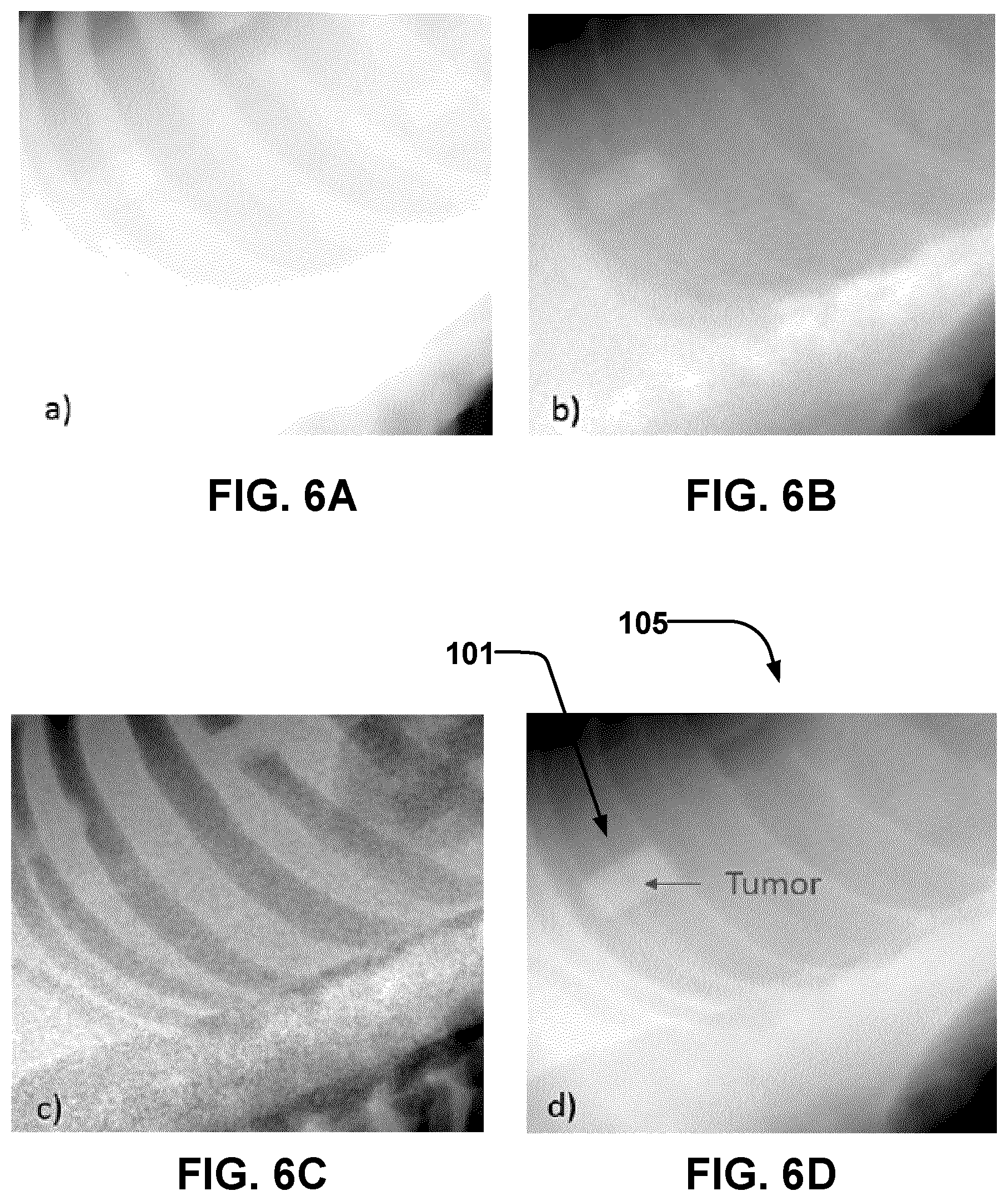 Patent US12376812 Figure 19 – Methods and apparatus for dual energy X-ray imaging