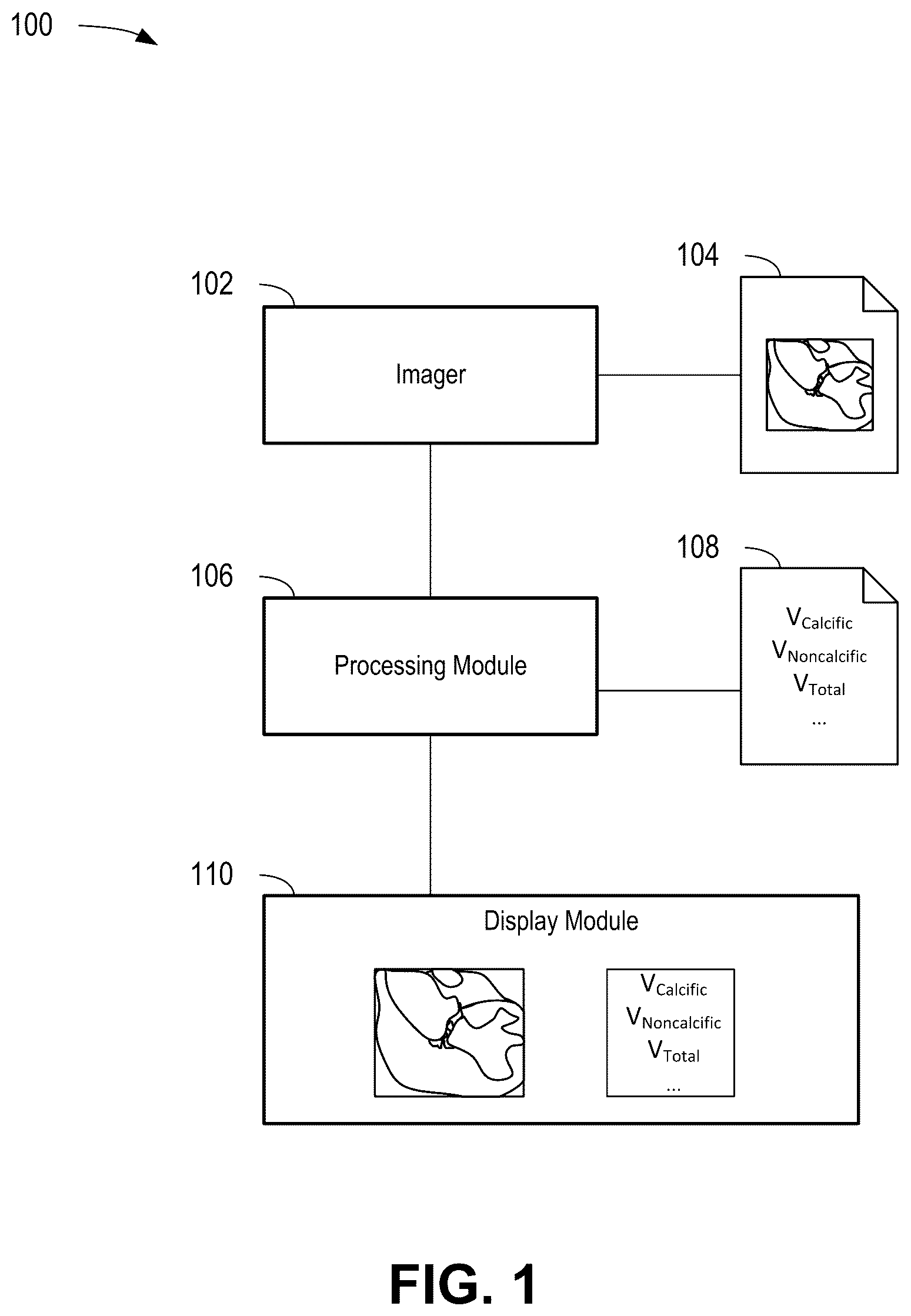 Patent US12376814 Figure 1 – Quantification of noncalcific and calcific valve tissue from coronary CT angiography