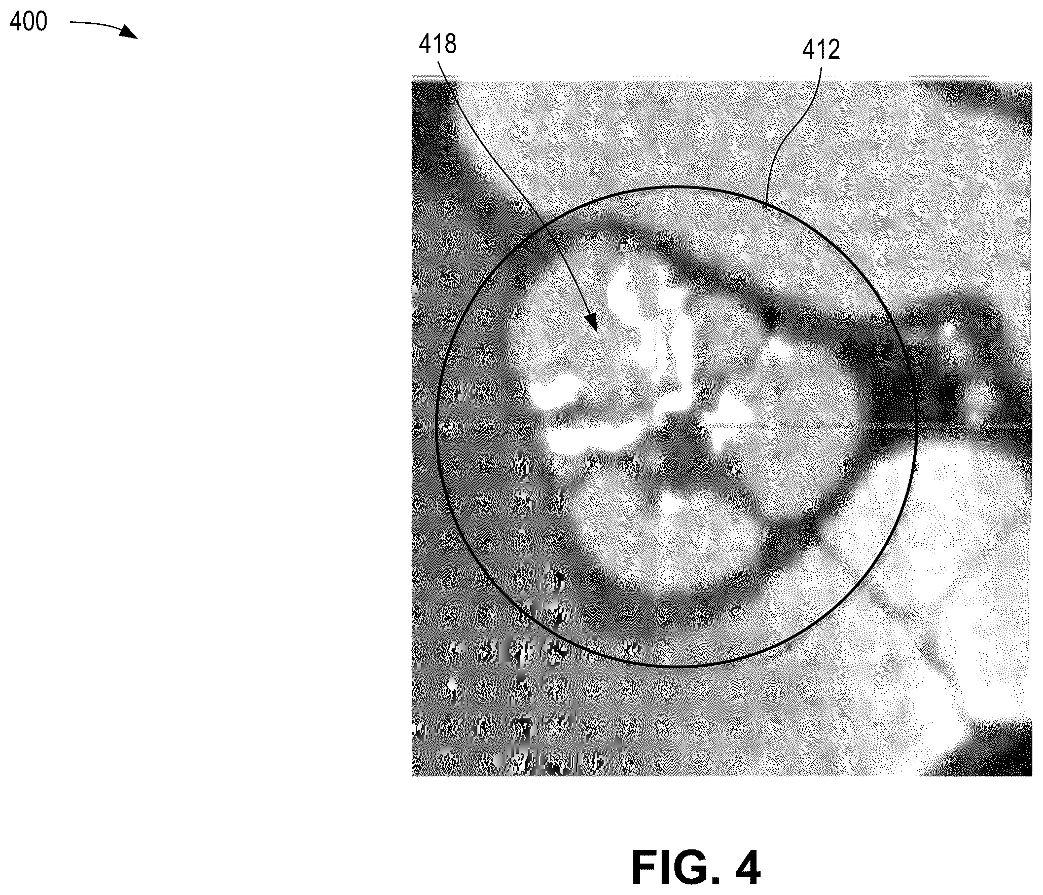 Patent US12376814 Figure 4 – Quantification of noncalcific and calcific valve tissue from coronary CT angiography